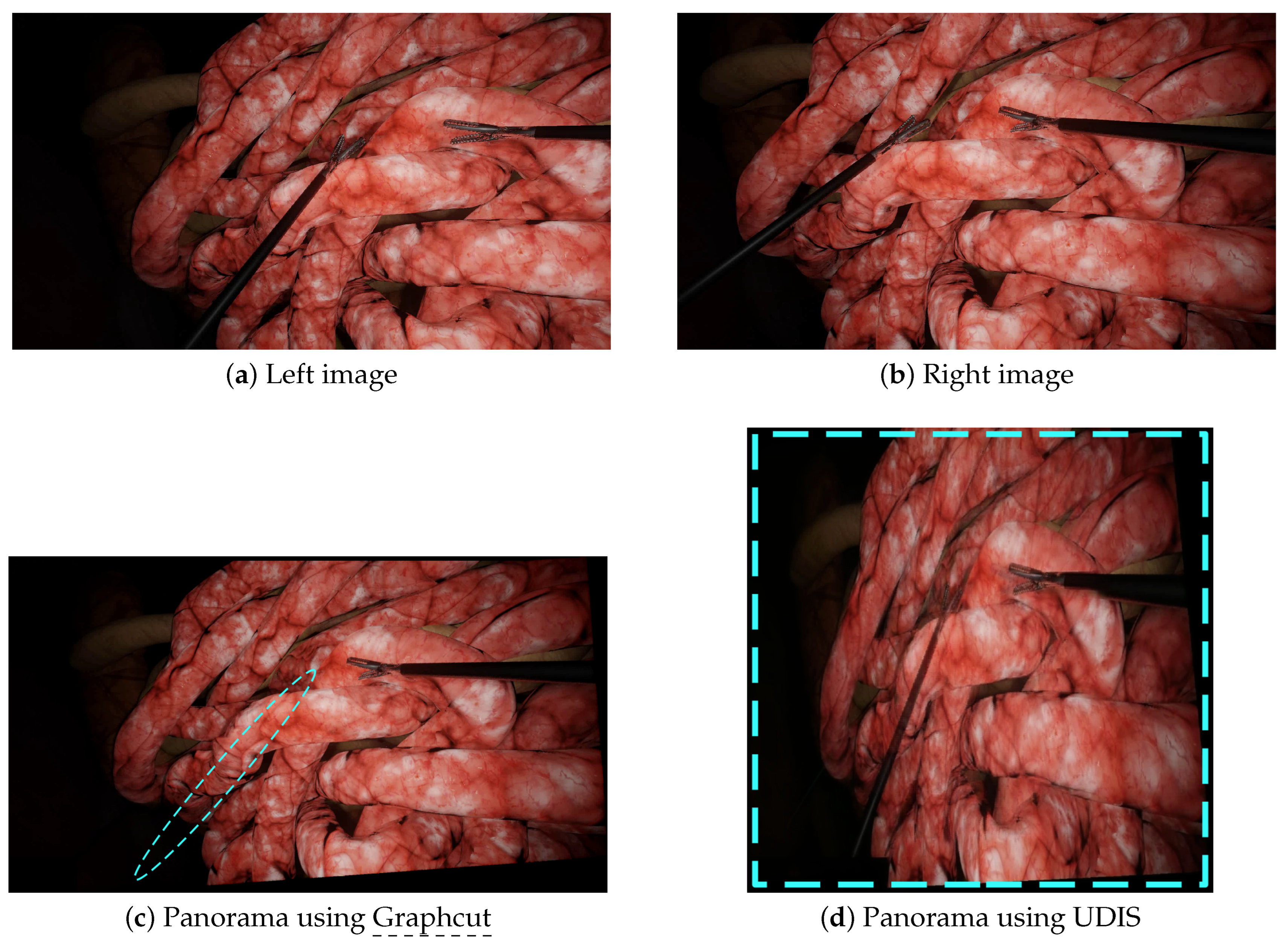 Jimaging 08 00052 g006