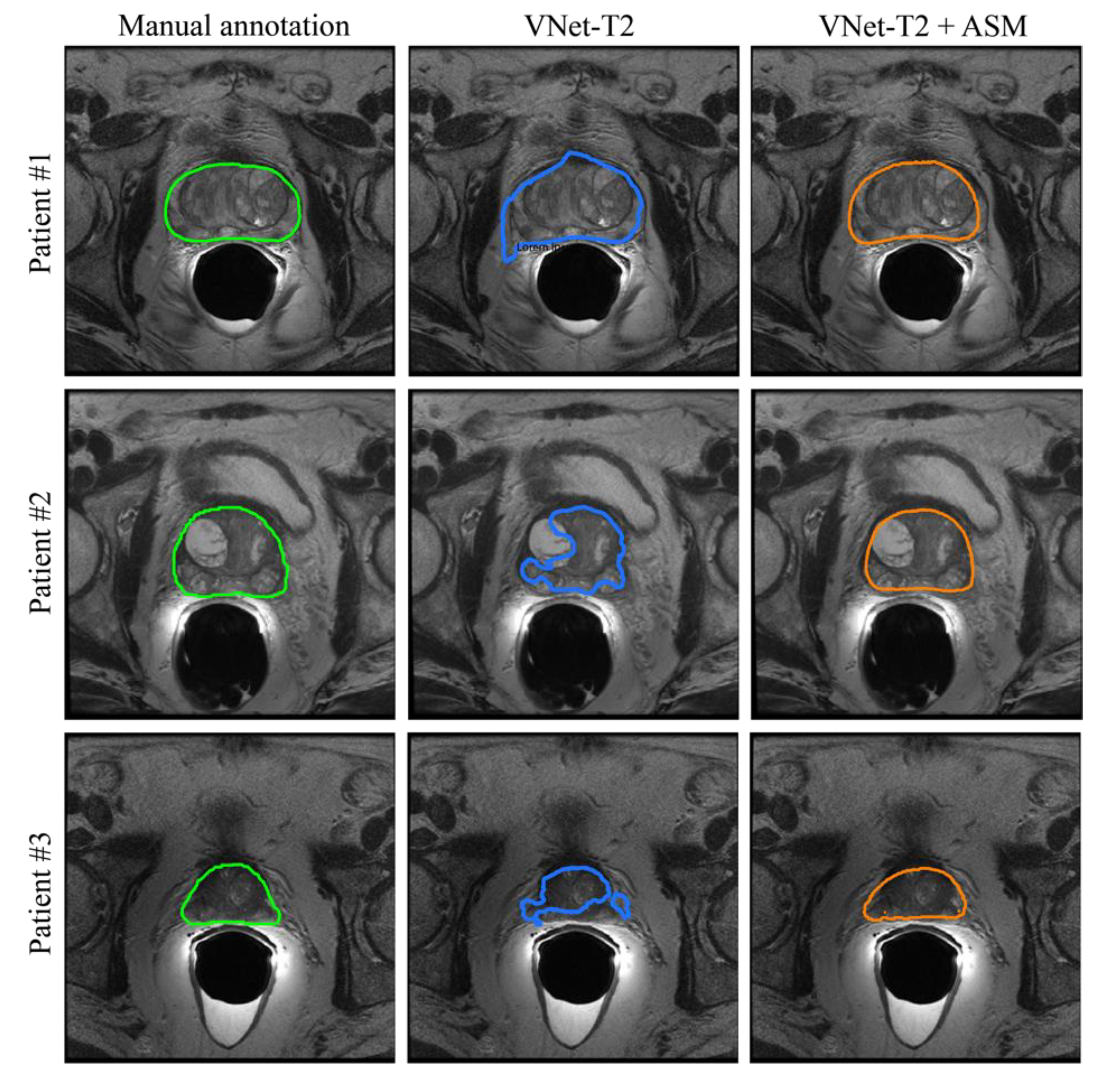 Jimaging 08 00133 g007