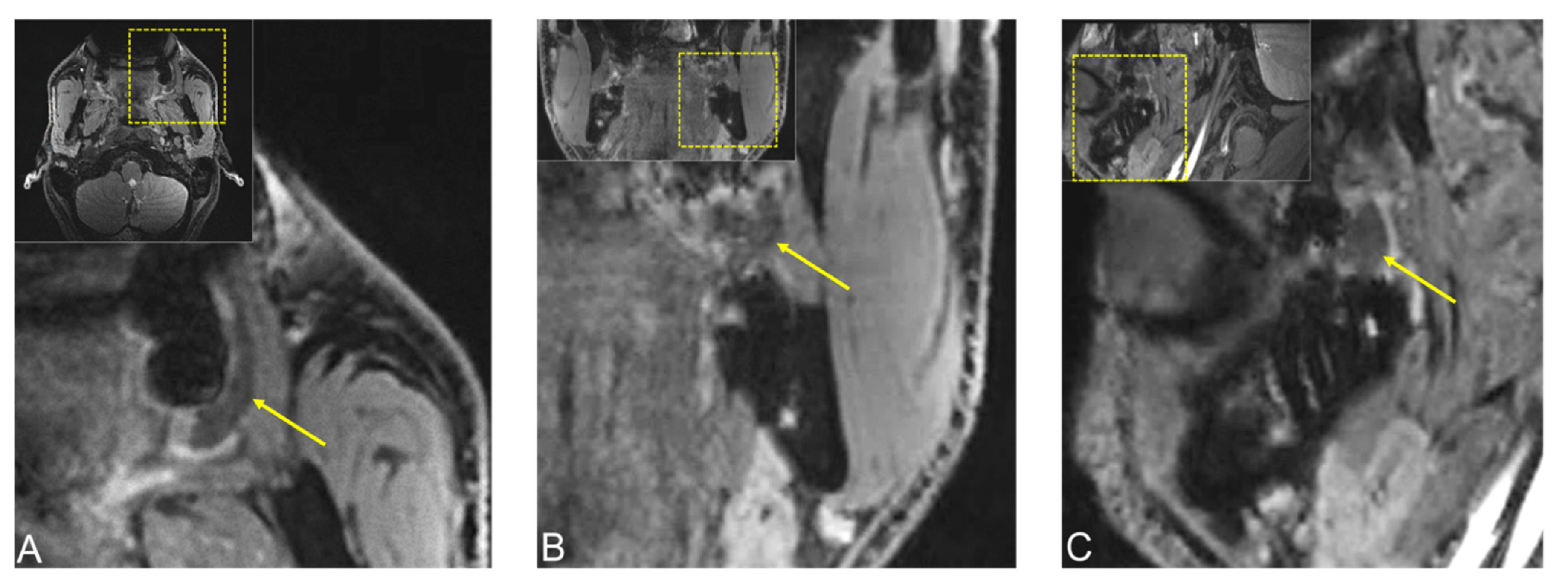 Jimaging 08 00146 g005