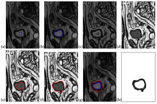 Jimaging 08 00151 g006 550