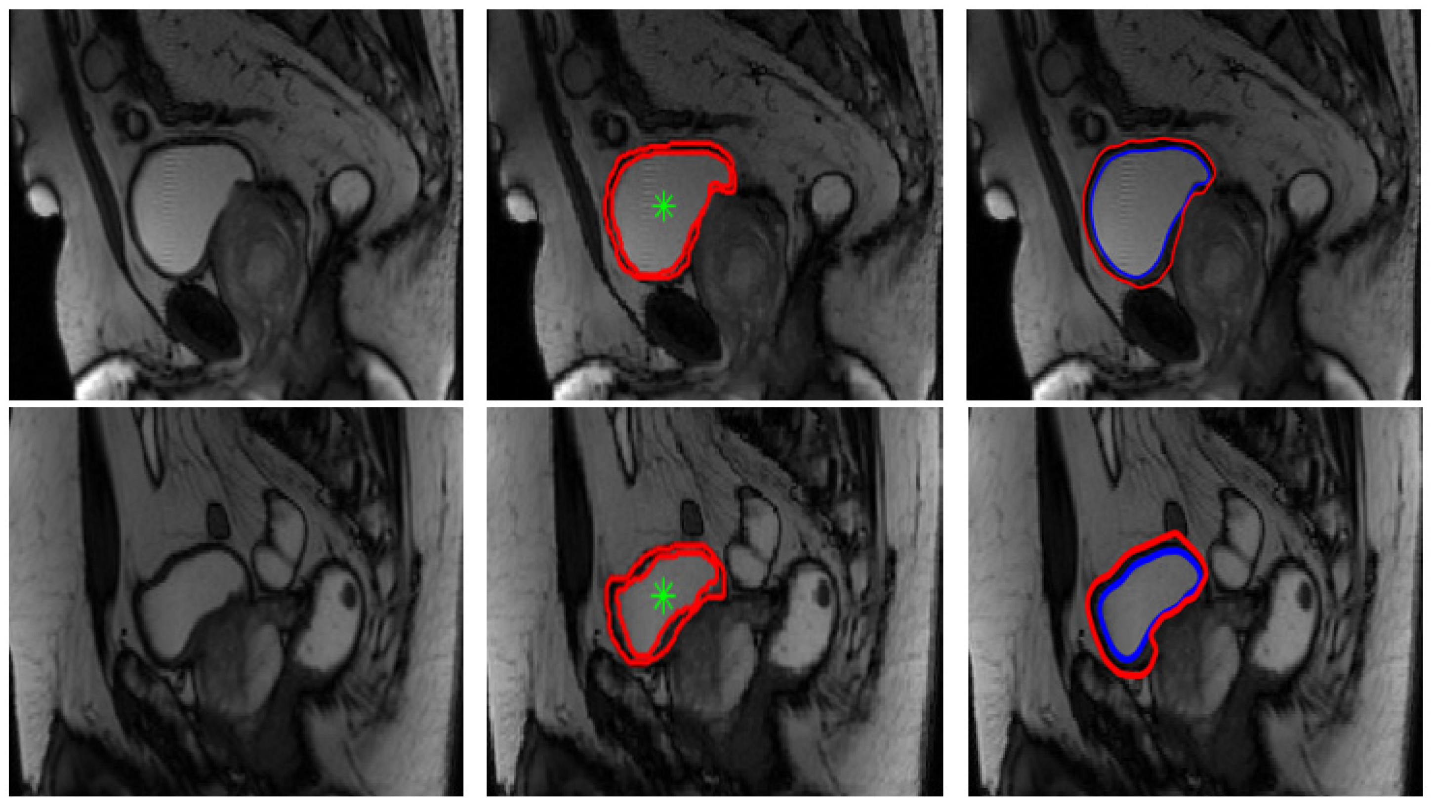 Jimaging 08 00151 g007b