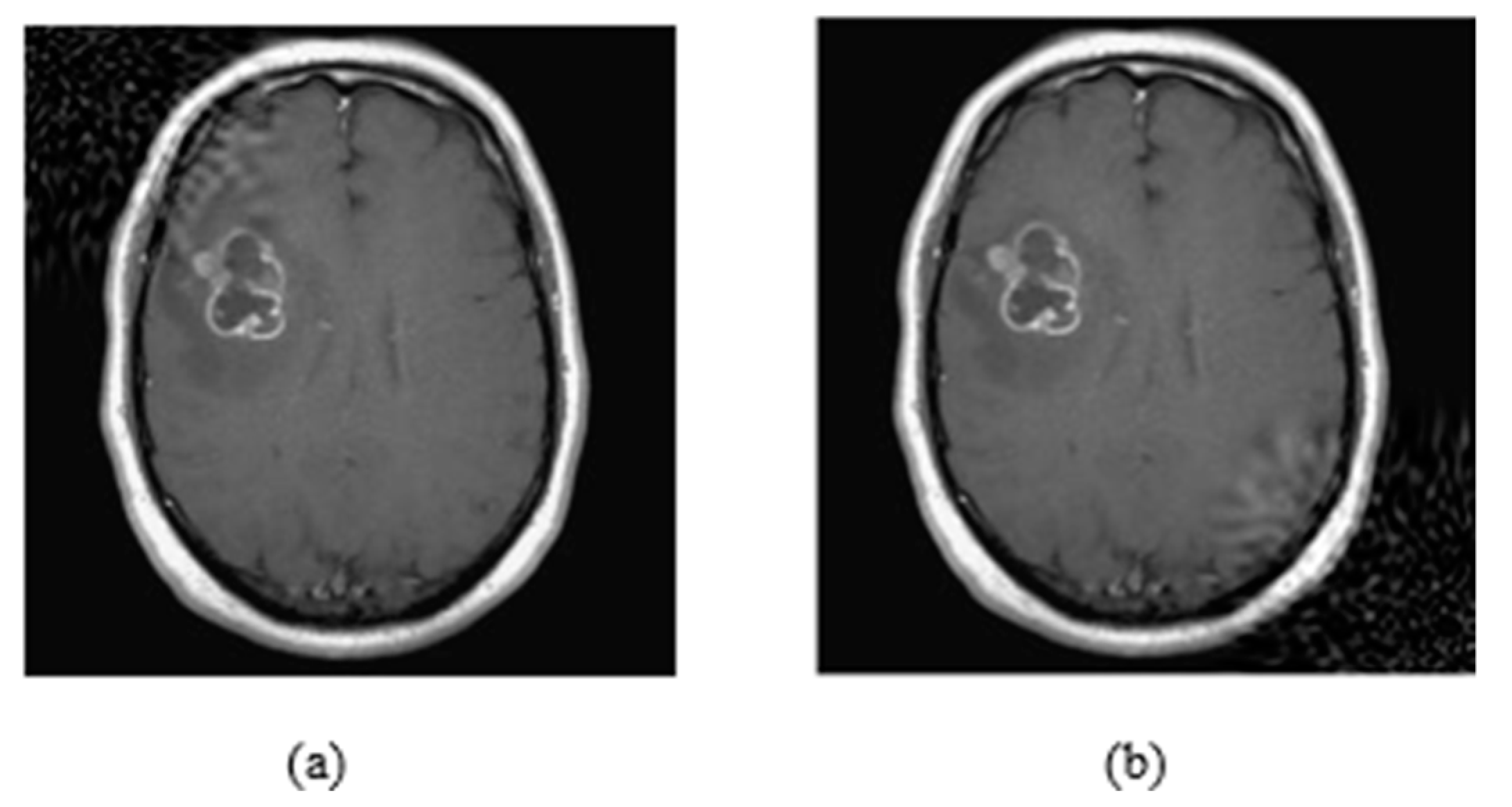 Jimaging 08 00155 g003
