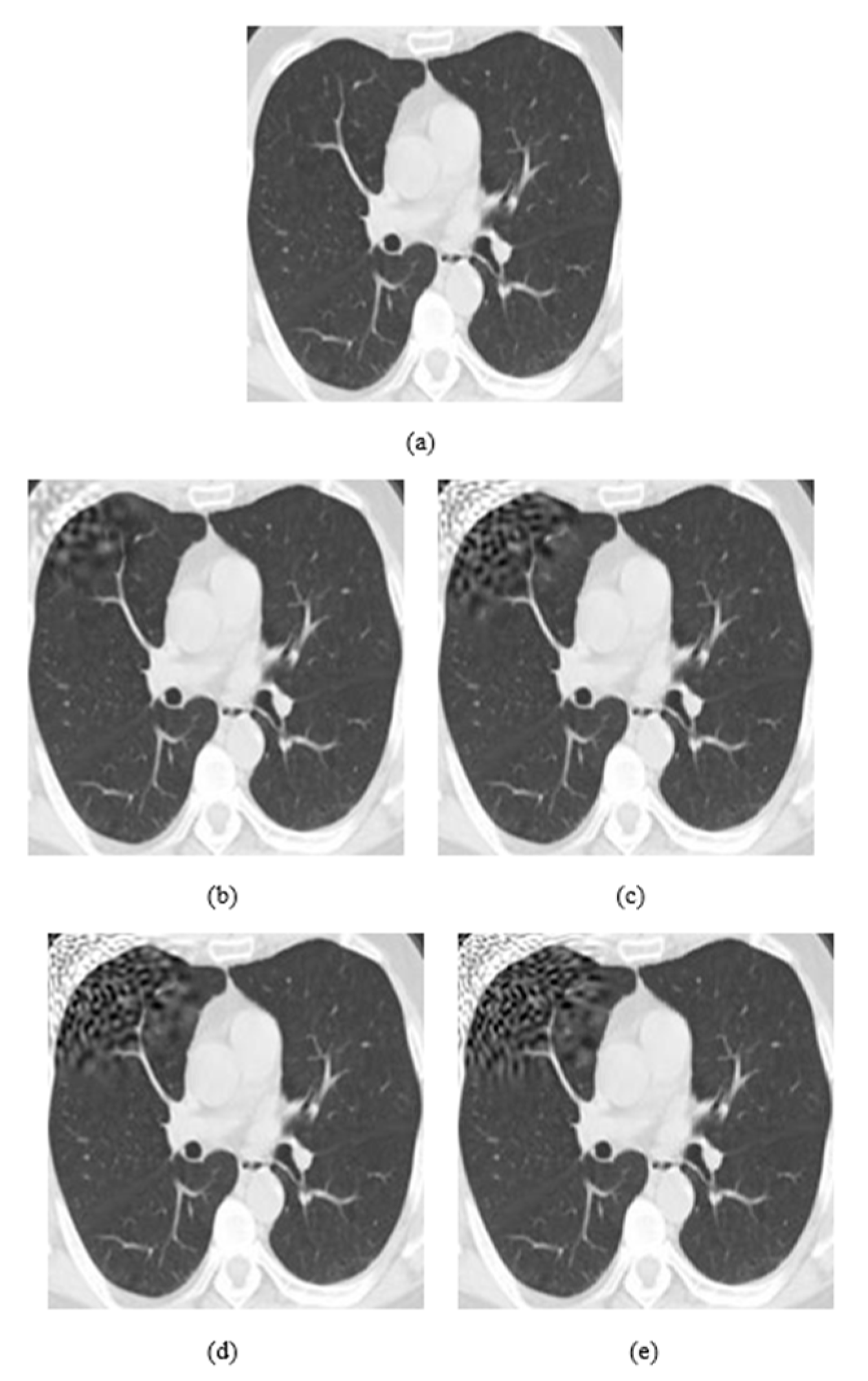 Jimaging 08 00155 g005