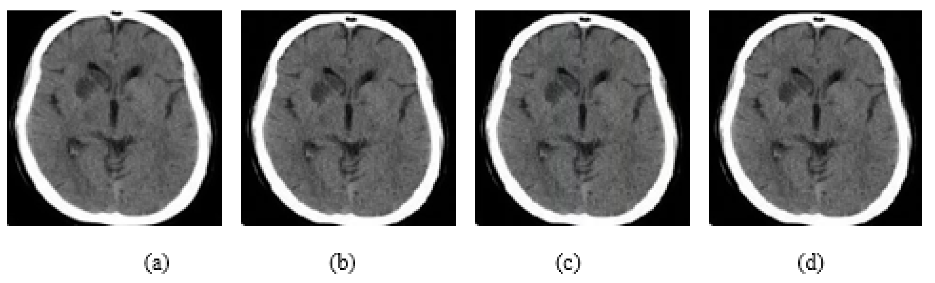 Jimaging 08 00155 g006