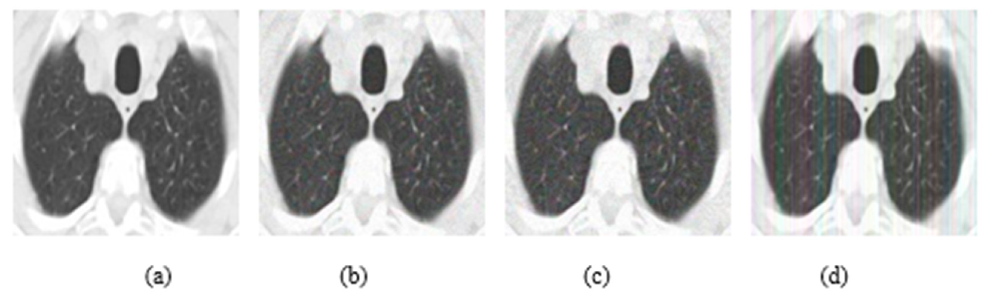 Jimaging 08 00155 g007