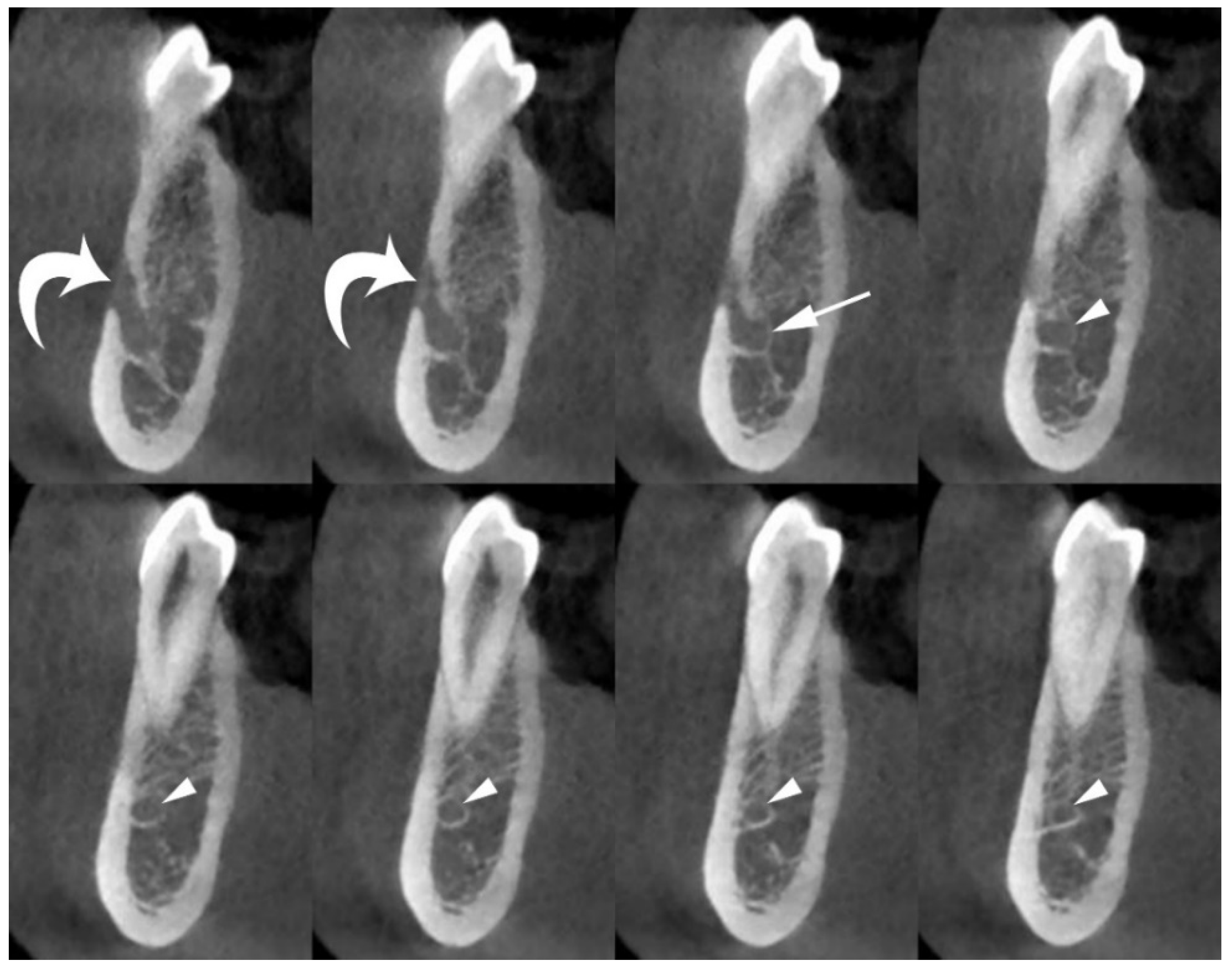 Jimaging 08 00161 g002