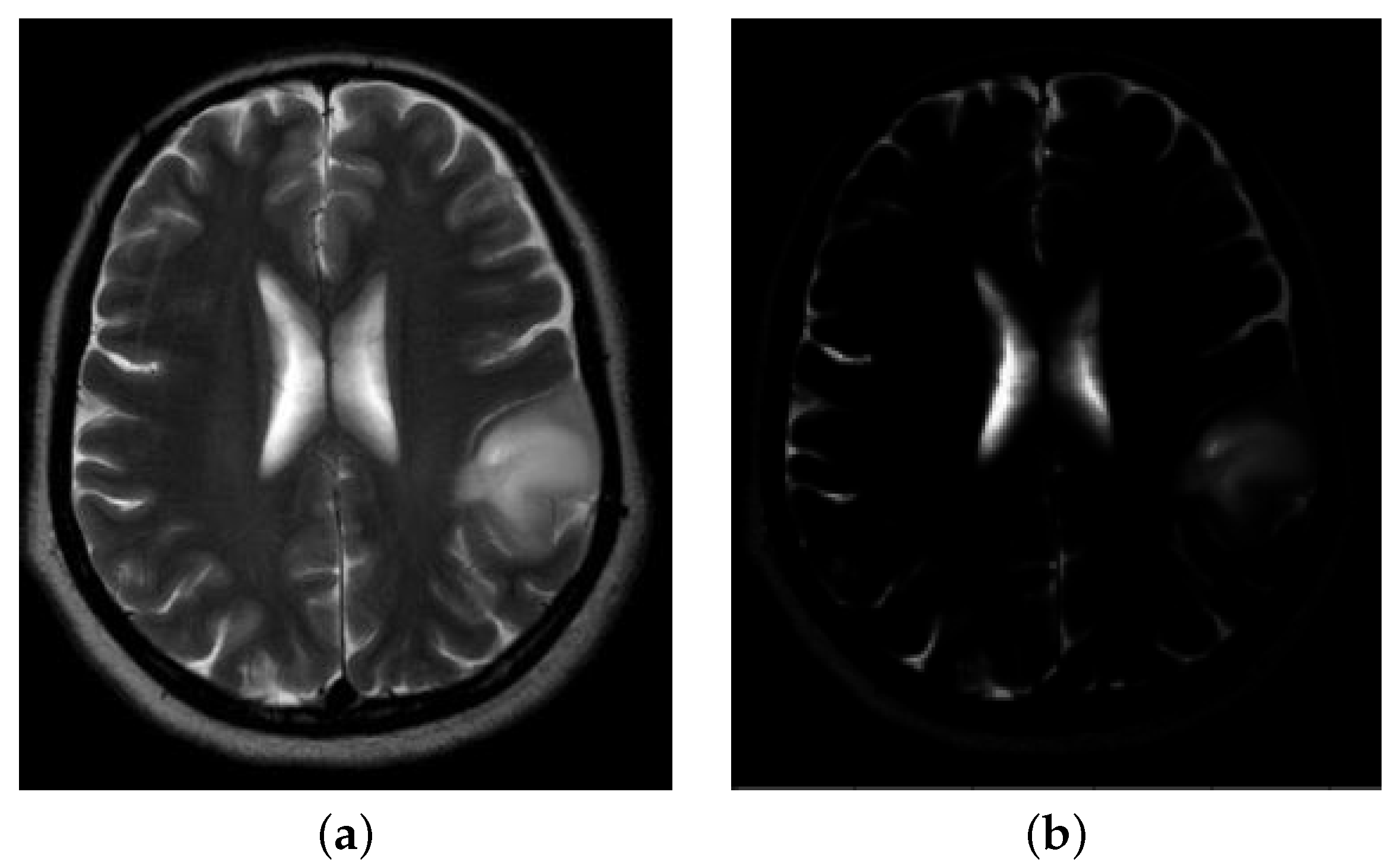 Jimaging 08 00301 g005