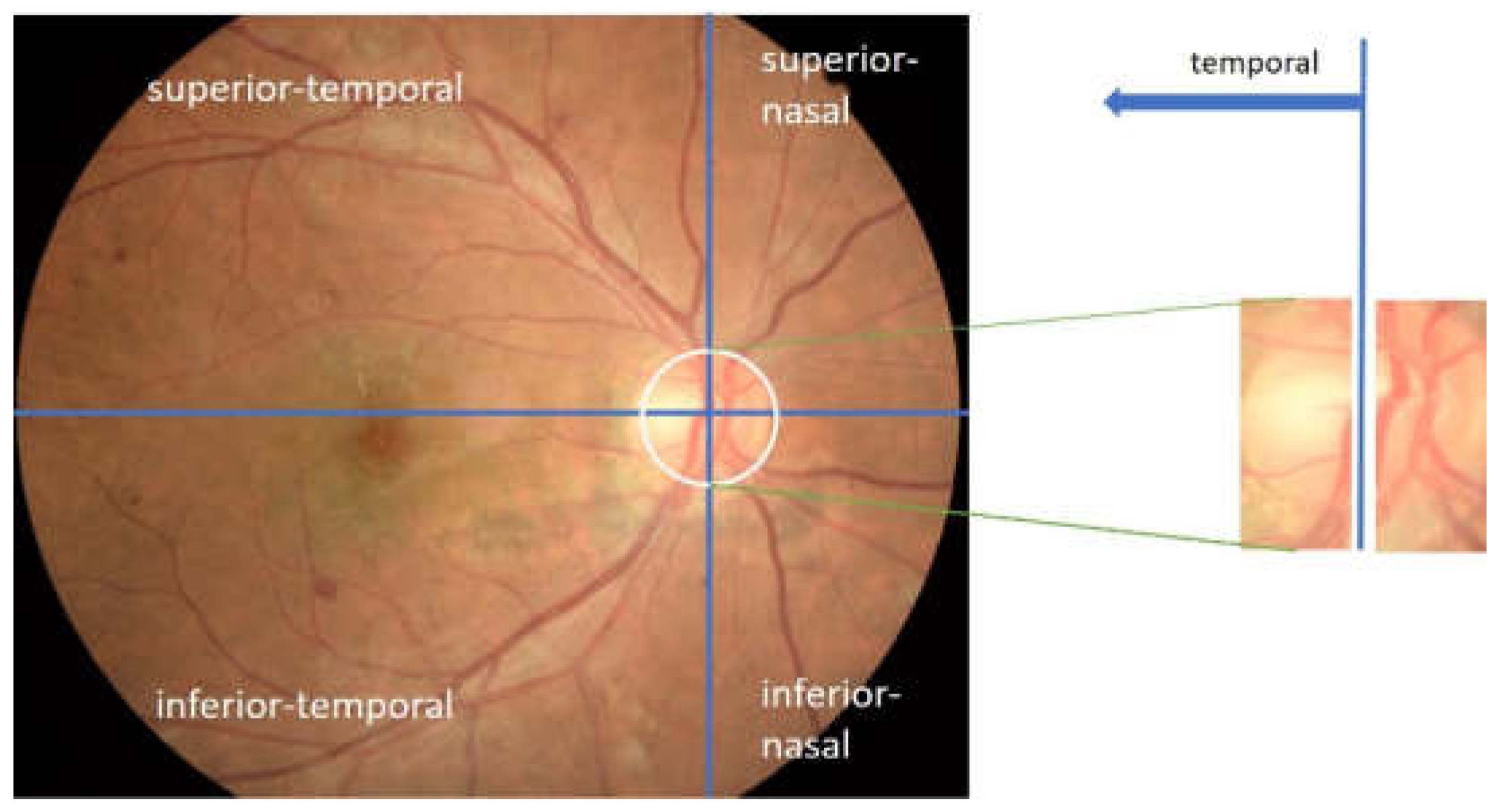 Jimaging 08 00313 g004