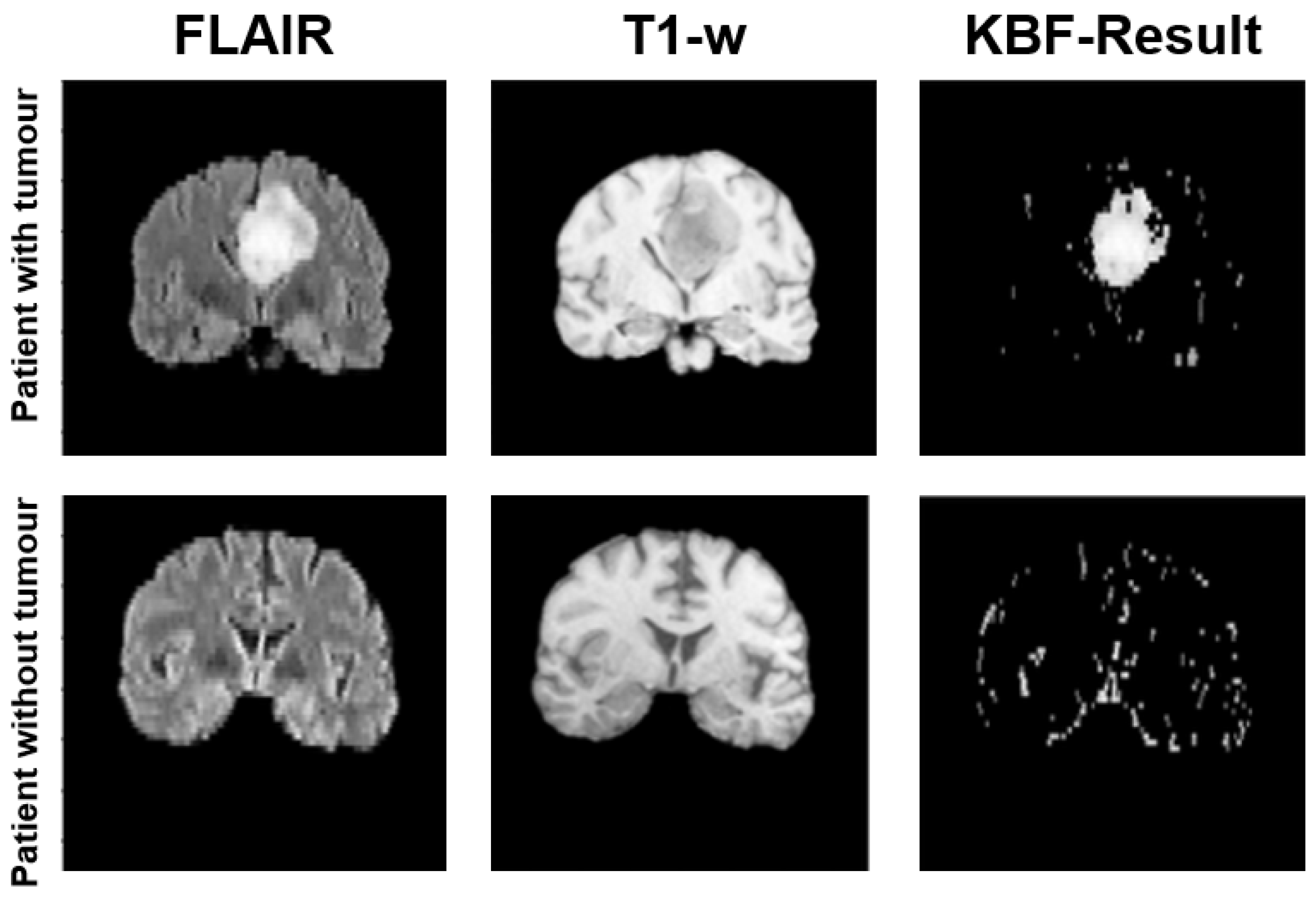 Jimaging 08 00321 g004 Jimaging 08 00321 g004