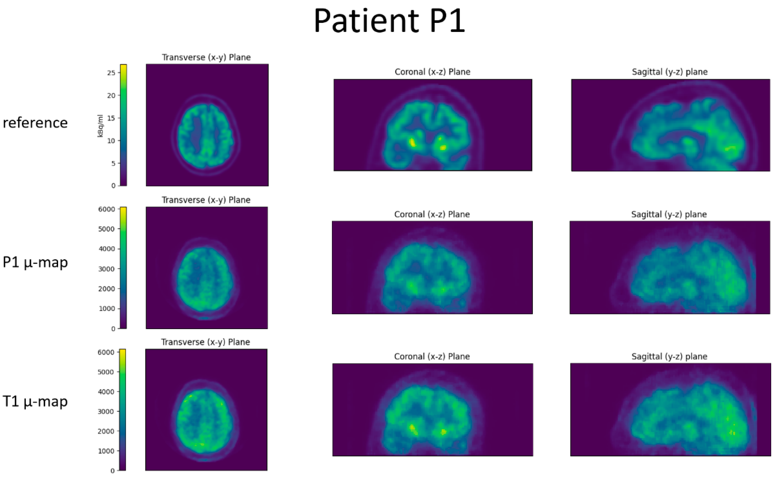 Jimaging 09 00002 g006