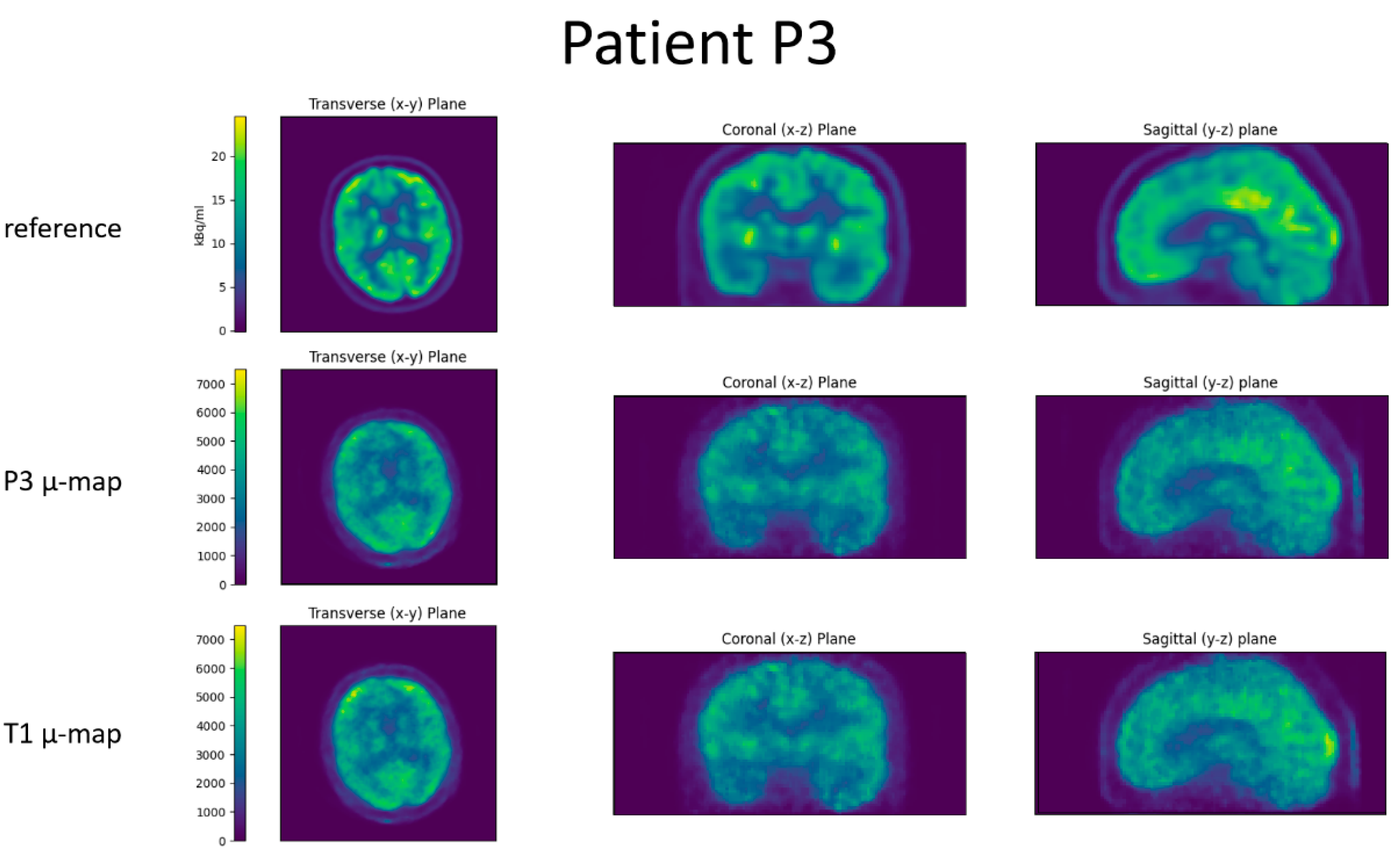 Jimaging 09 00002 g008