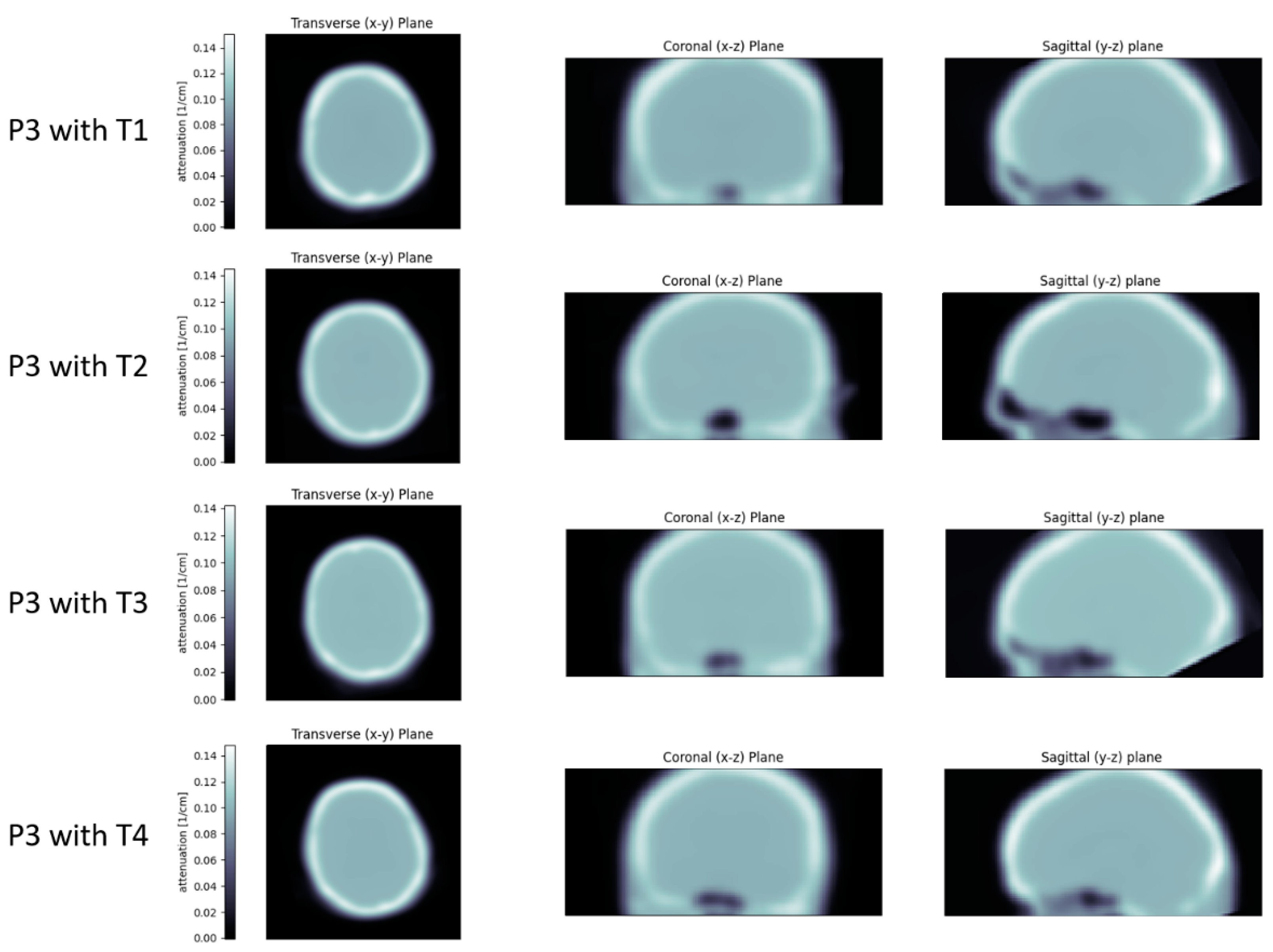 Jimaging 09 00002 g011