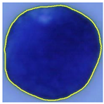 Jimaging 09 00013 i001 Jimaging 09 00013 i001