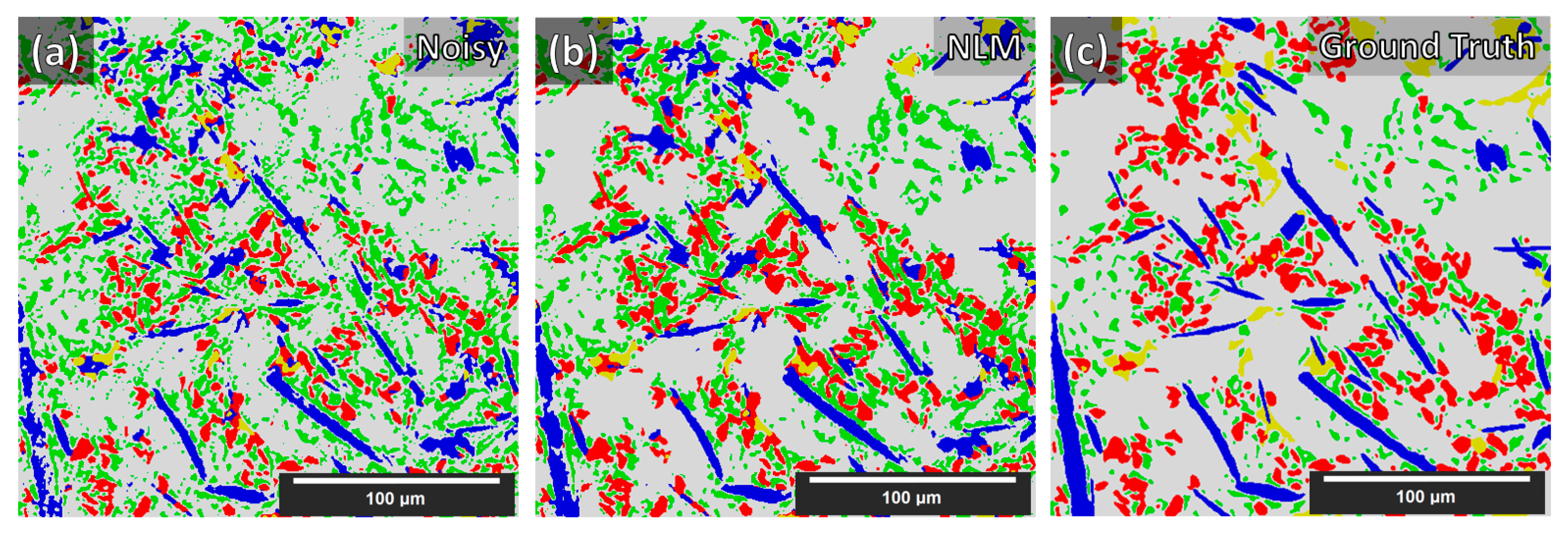 Jimaging 09 00022 g011 Jimaging 09 00022 g011