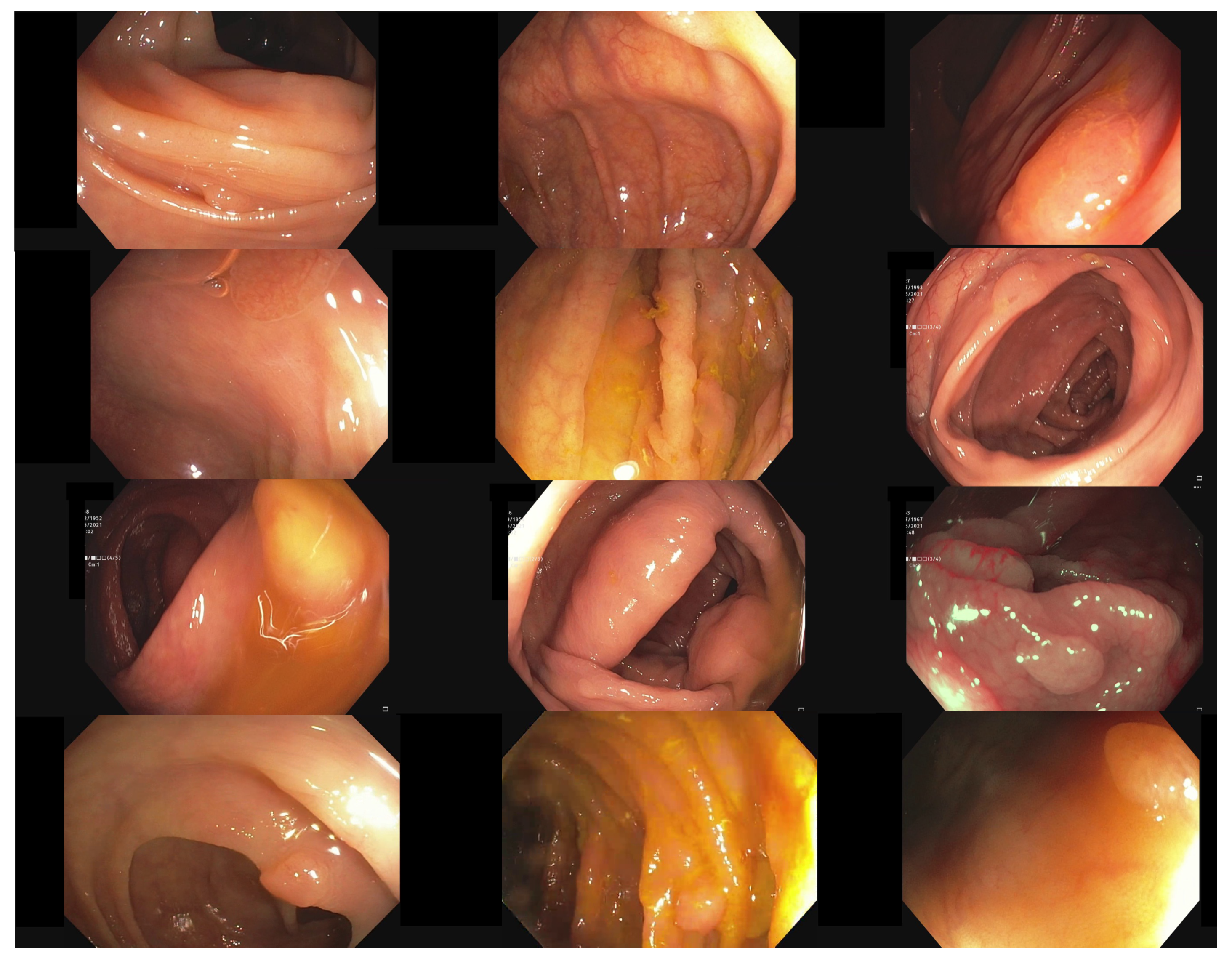 Jimaging 09 00026 g013