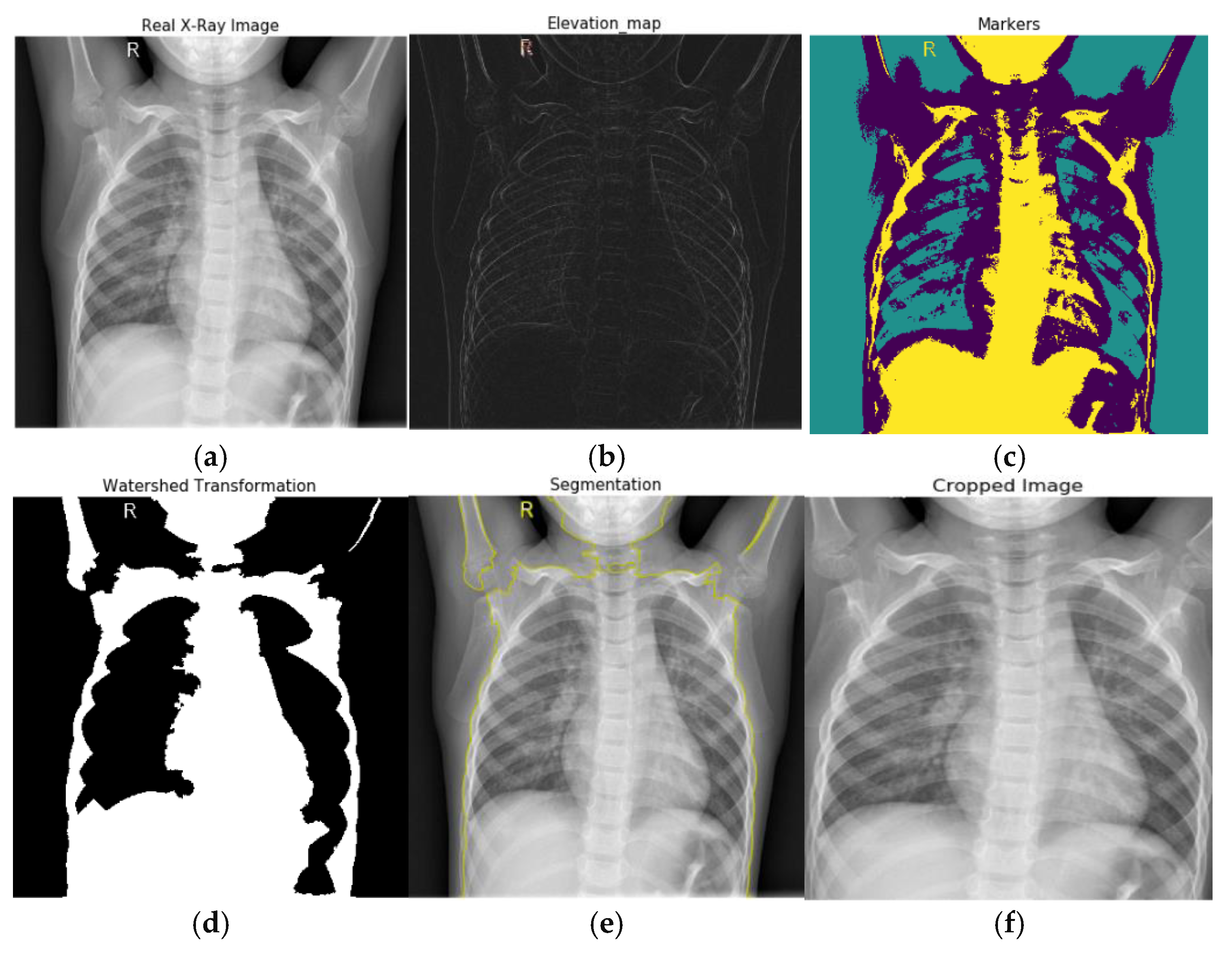 Jimaging 09 00042 g003