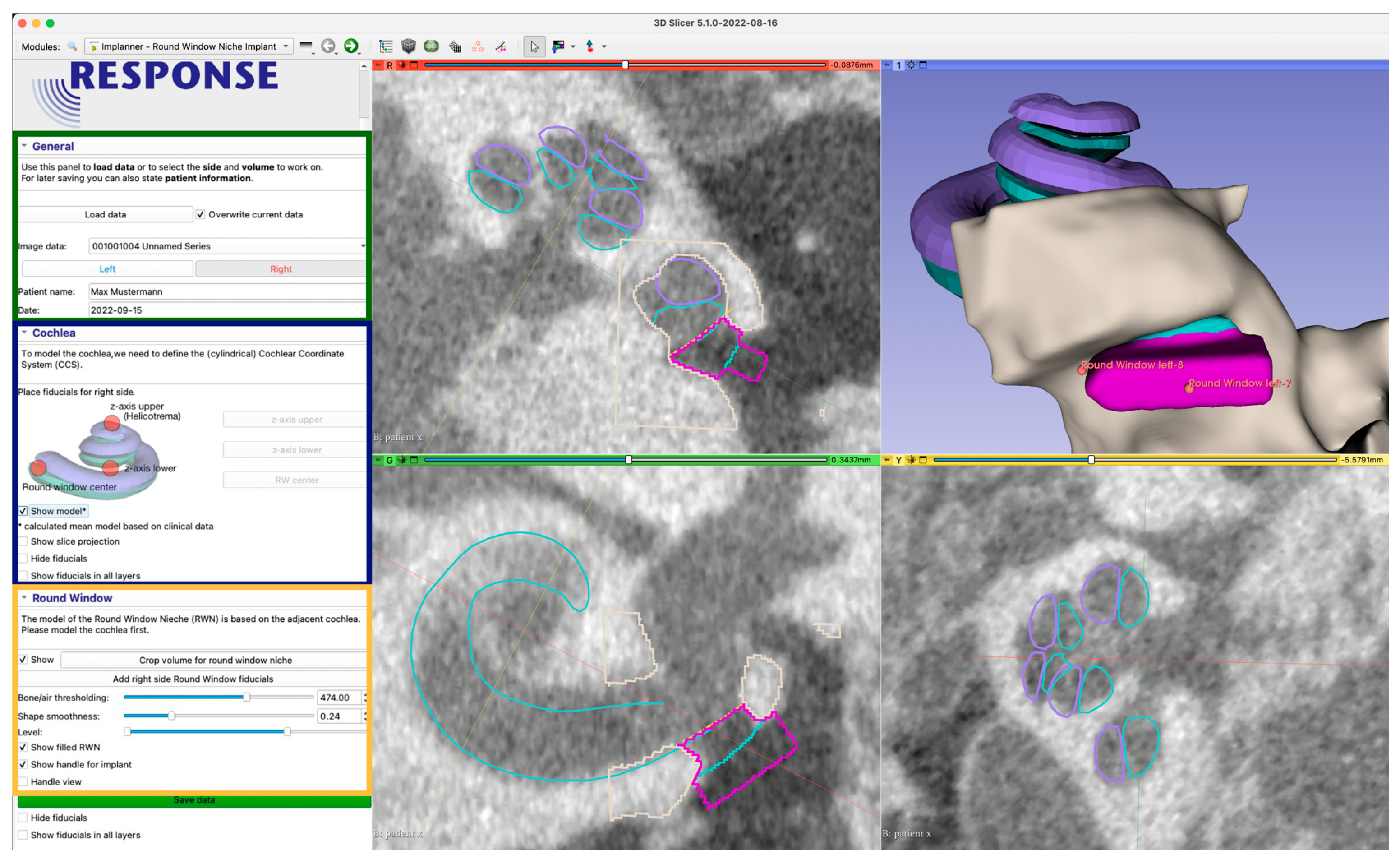 Jimaging 09 00051 g004