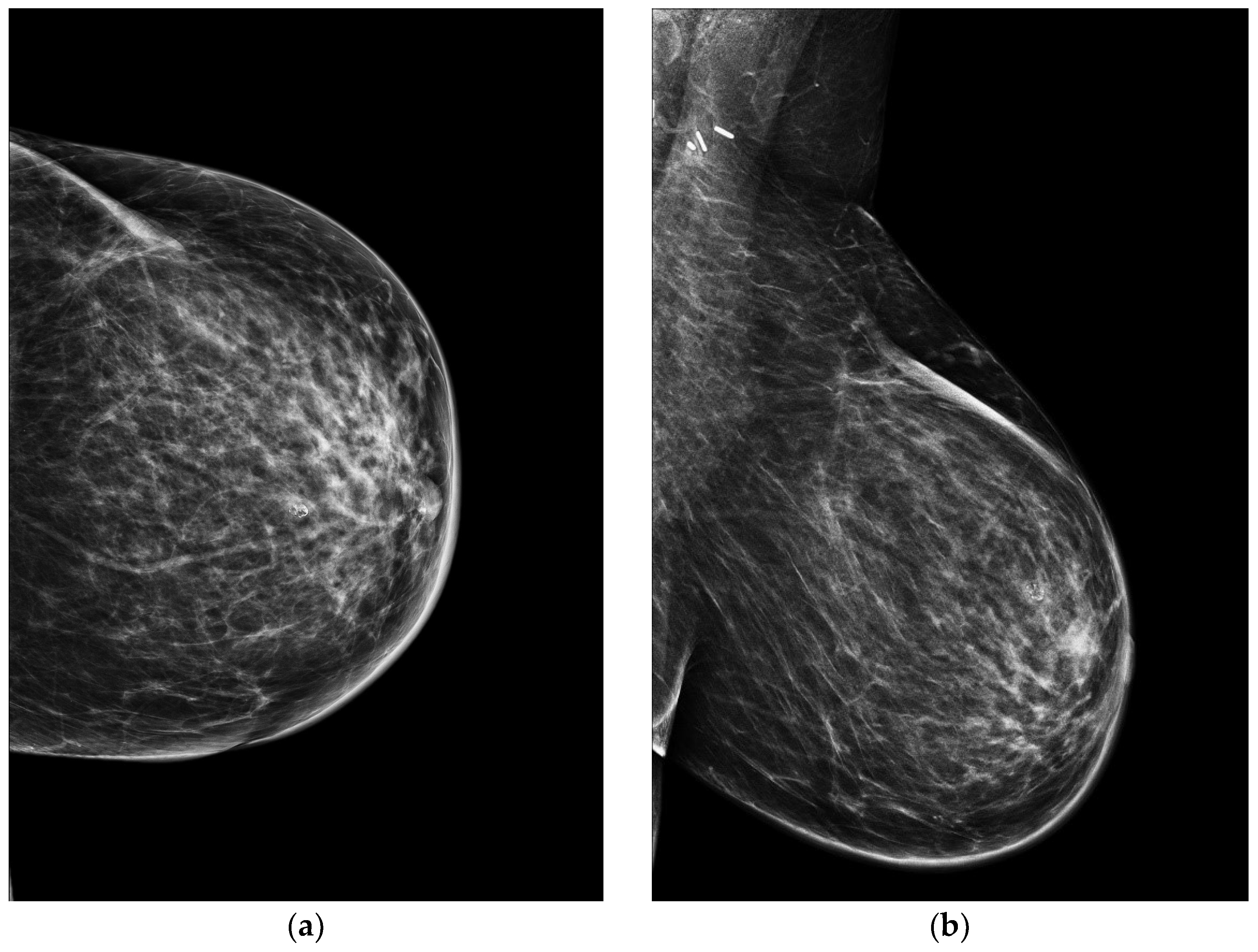 Jimaging 09 00094 g004