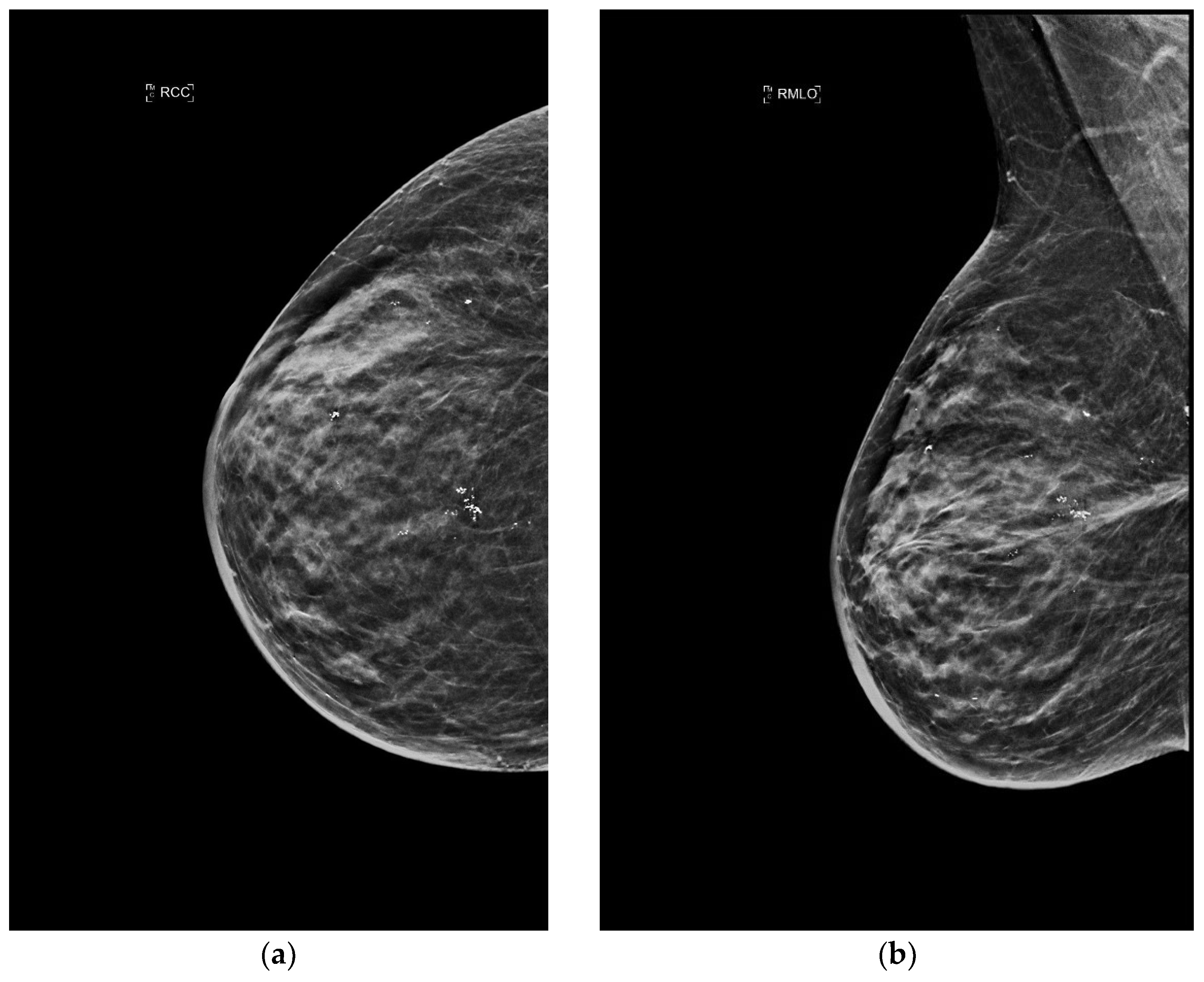 Jimaging 09 00094 g005