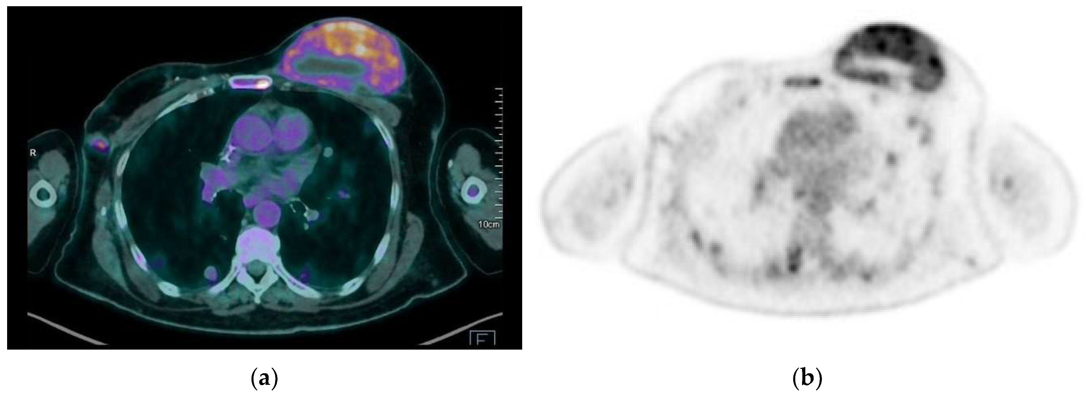 Jimaging 09 00094 g014