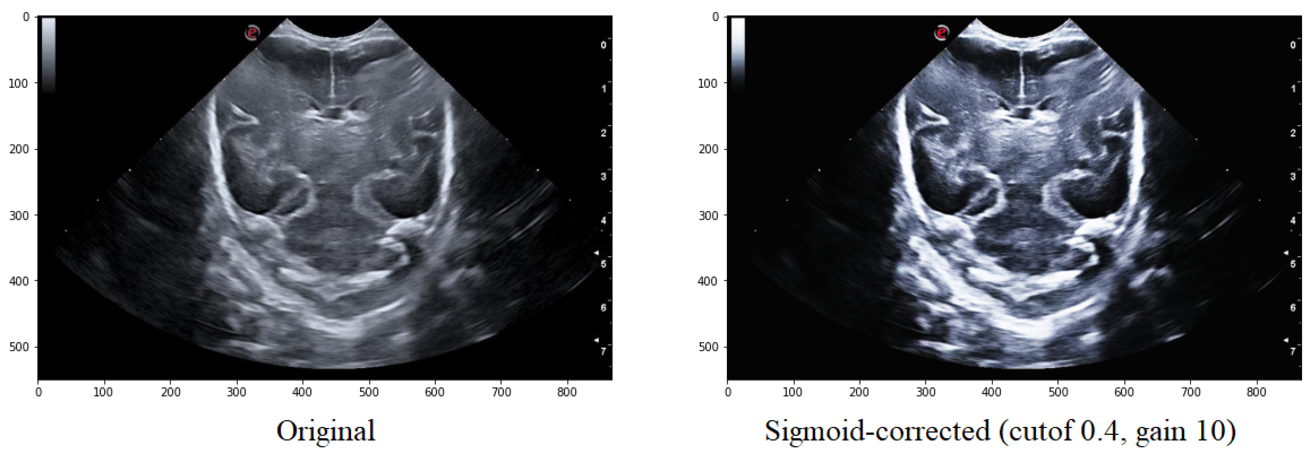 Jimaging 09 00145 g006