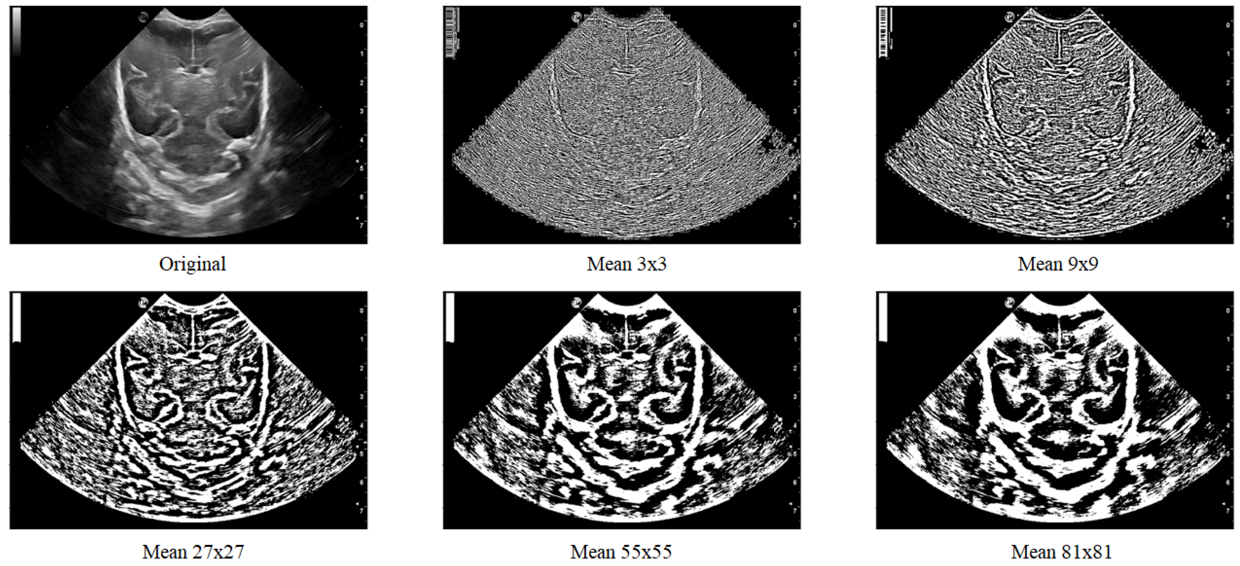 Jimaging 09 00145 g007