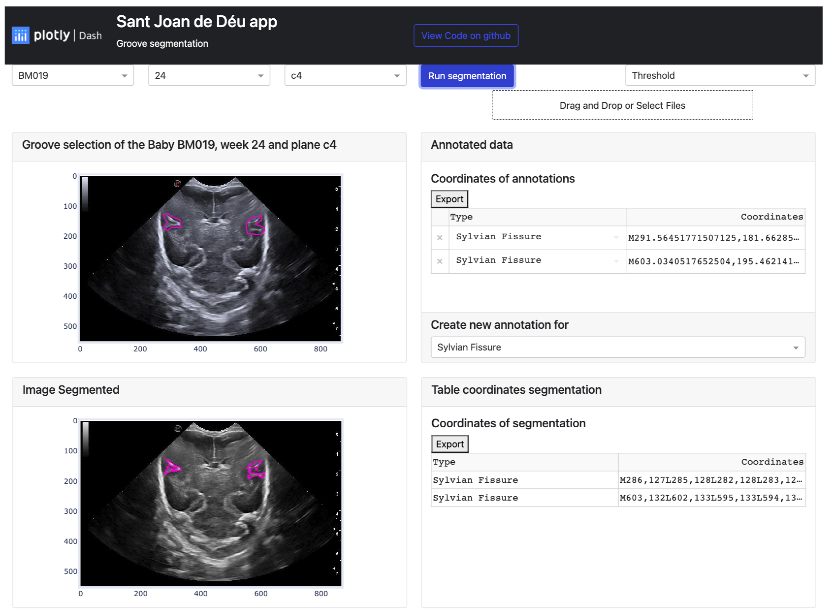 Jimaging 09 00145 g012