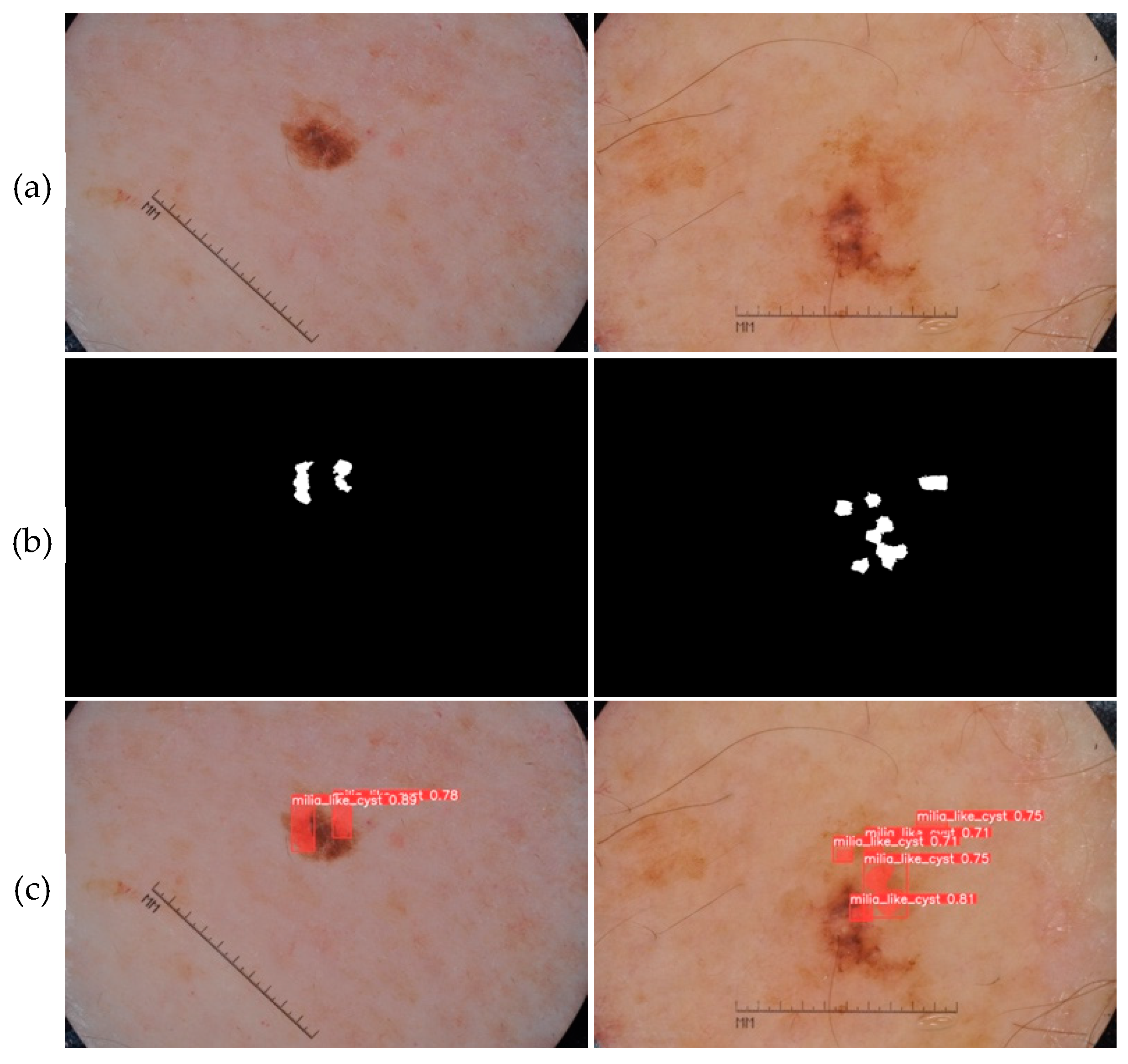 Jimaging 09 00148 g011 Jimaging 09 00148 g011