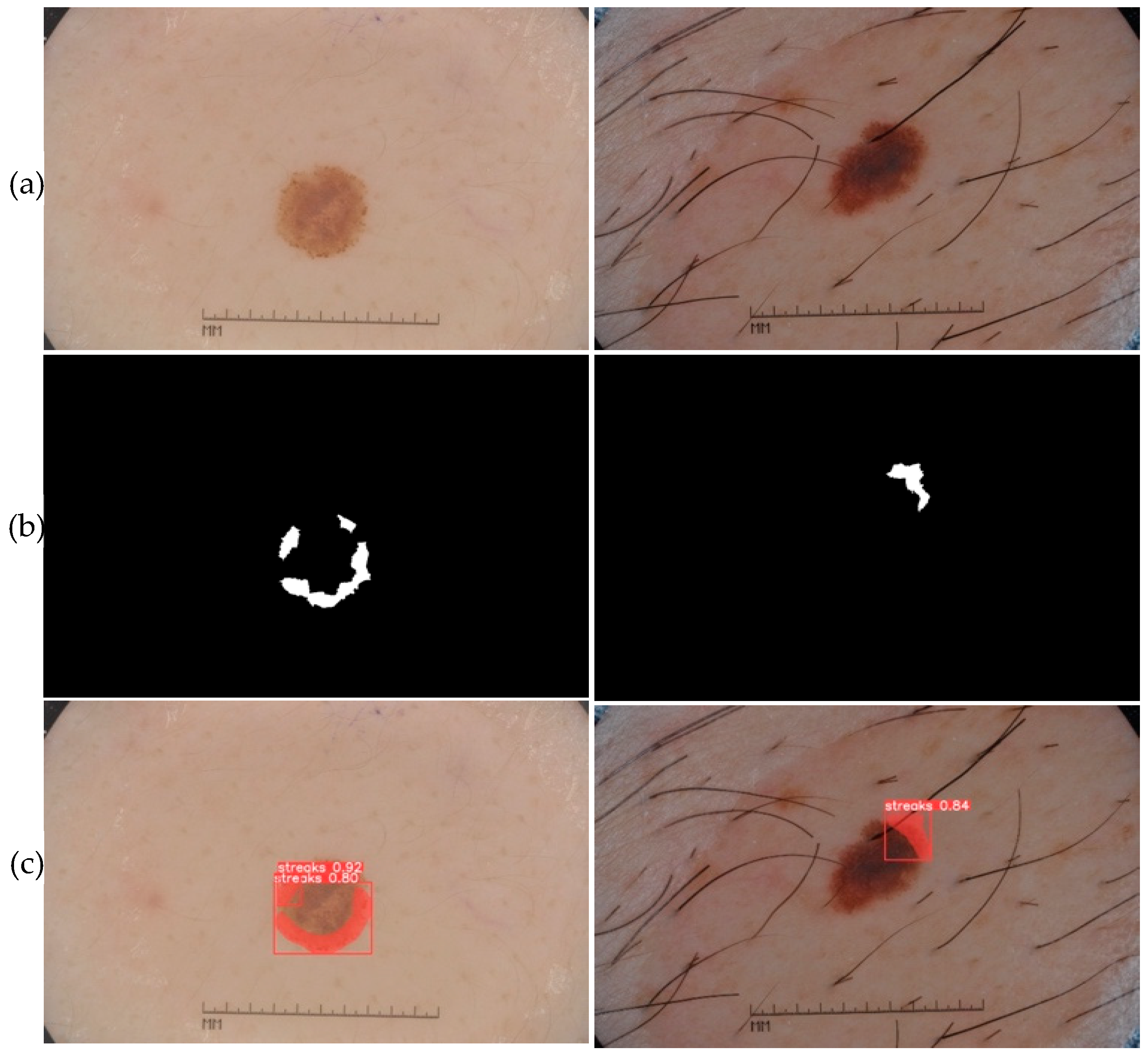 Jimaging 09 00148 g014 Jimaging 09 00148 g014