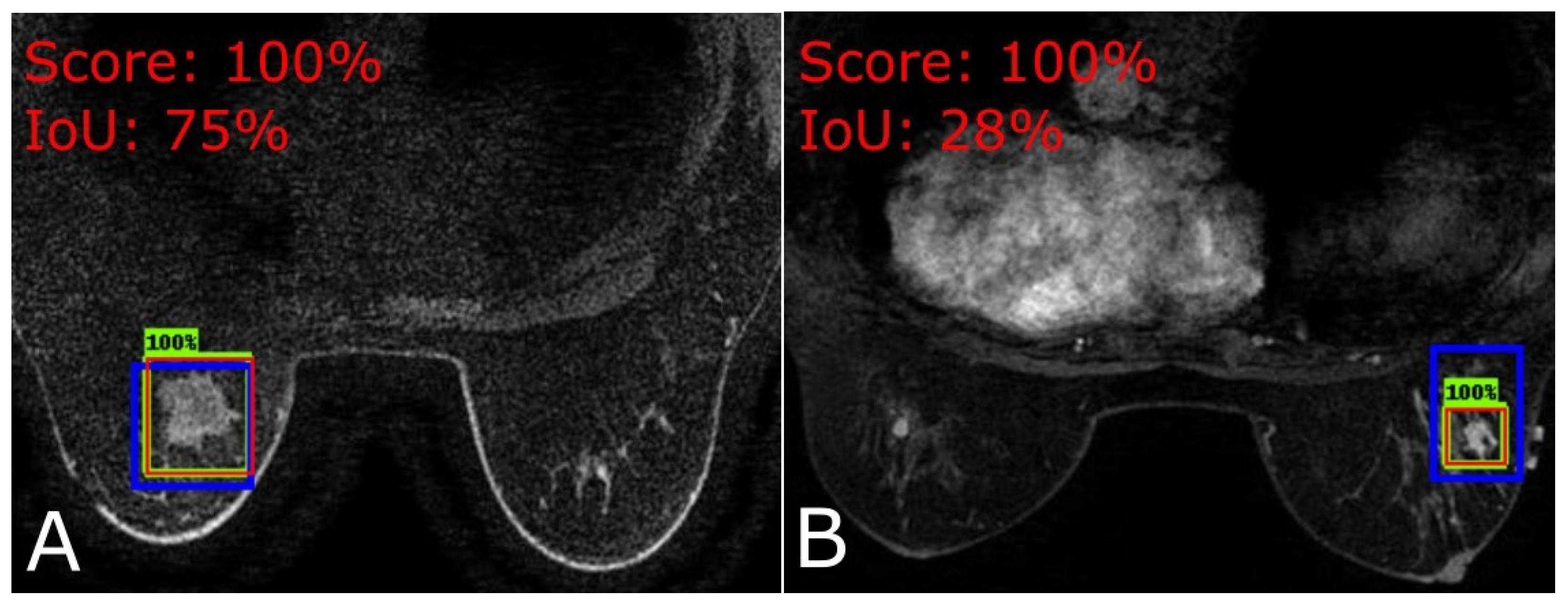 Jimaging 09 00169 g003