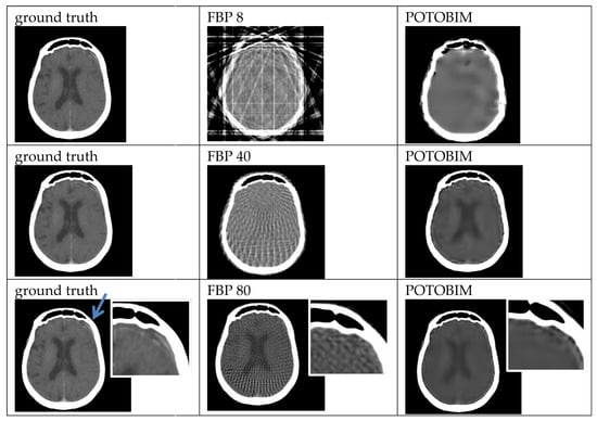 Jimaging 09 00170 g0a1