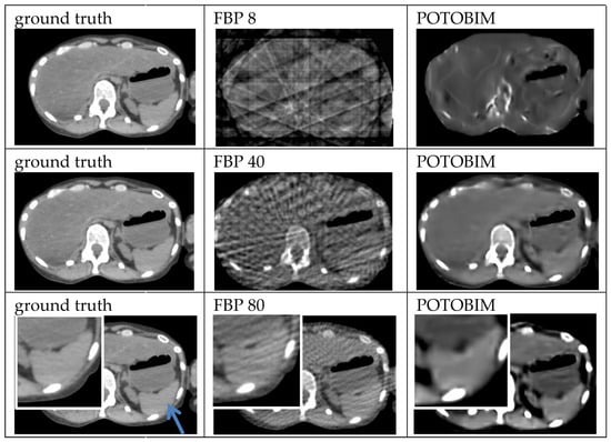 Jimaging 09 00170 g0a2