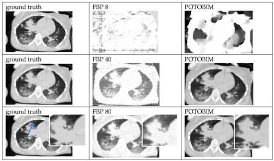 Jimaging 09 00170 g0a3