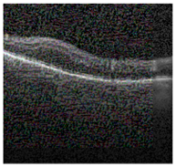 Jimaging 09 00219 i012