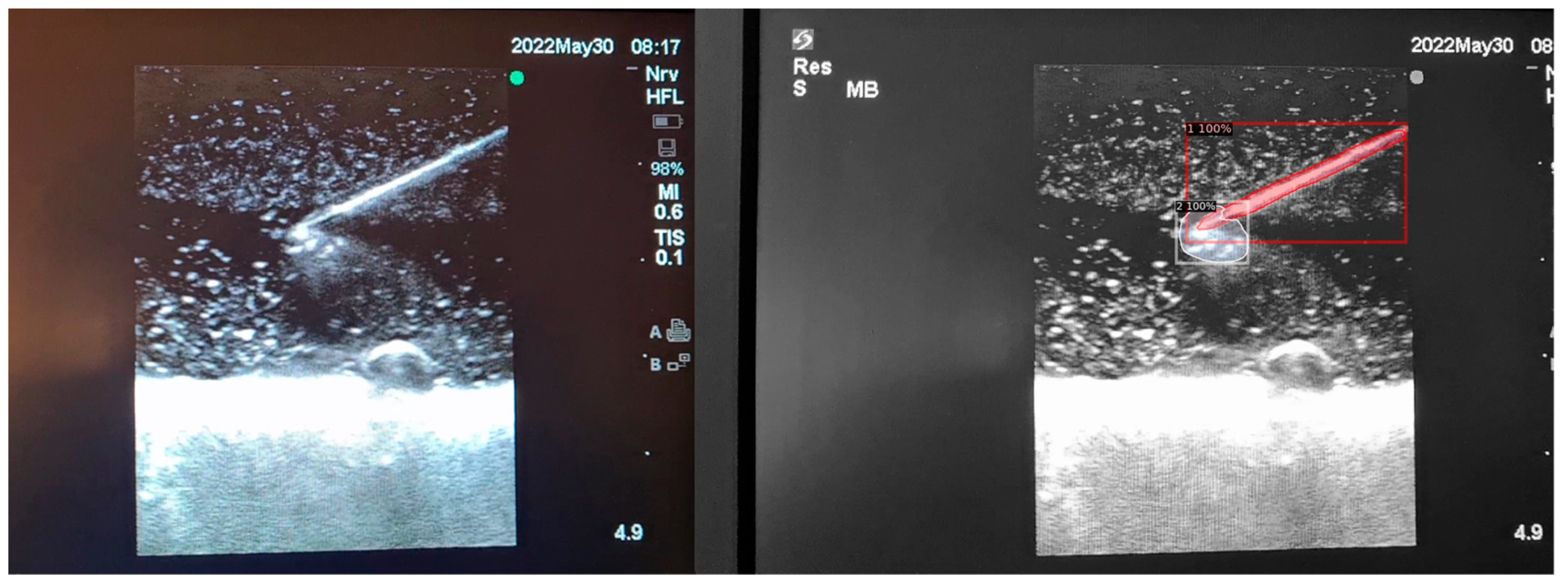 Jimaging 09 00225 g006 Jimaging 09 00225 g006