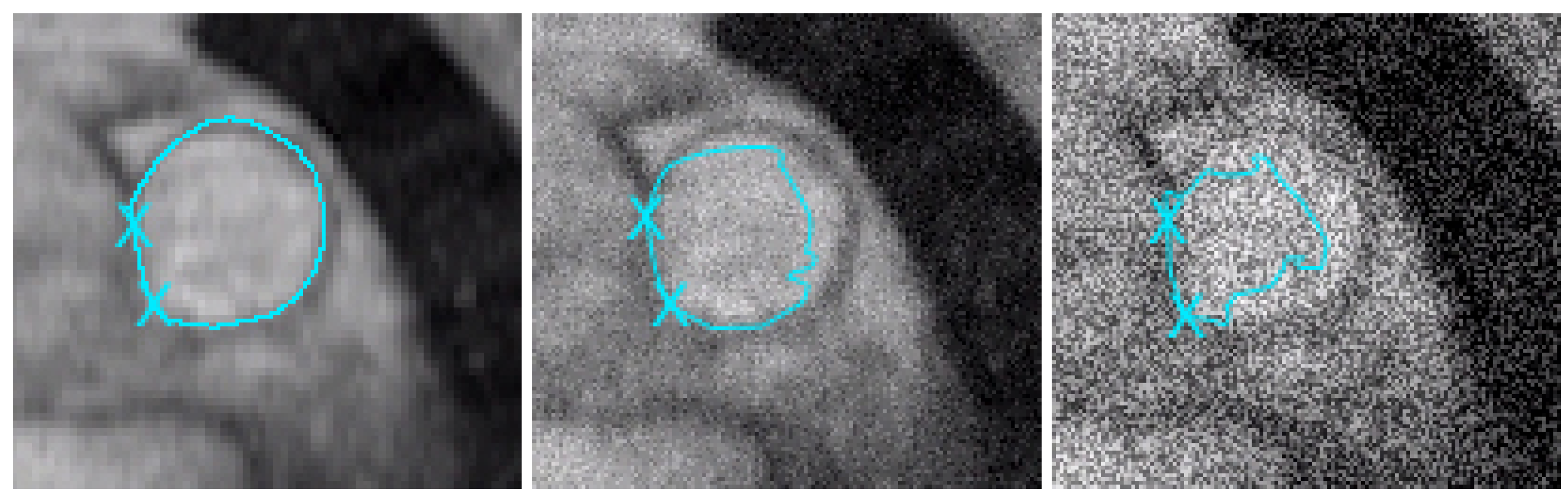 Jimaging 10 00002 g006