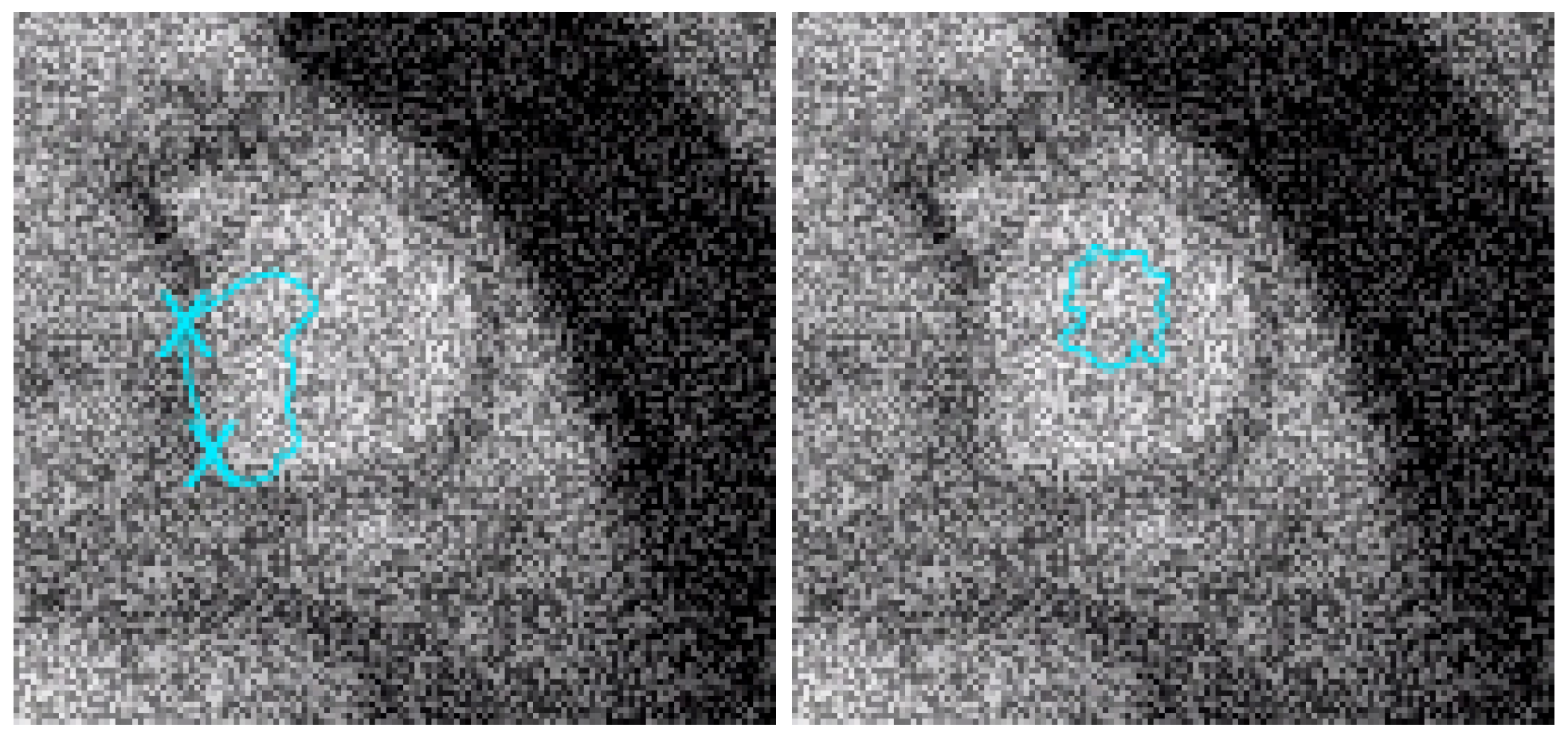 Jimaging 10 00002 g007