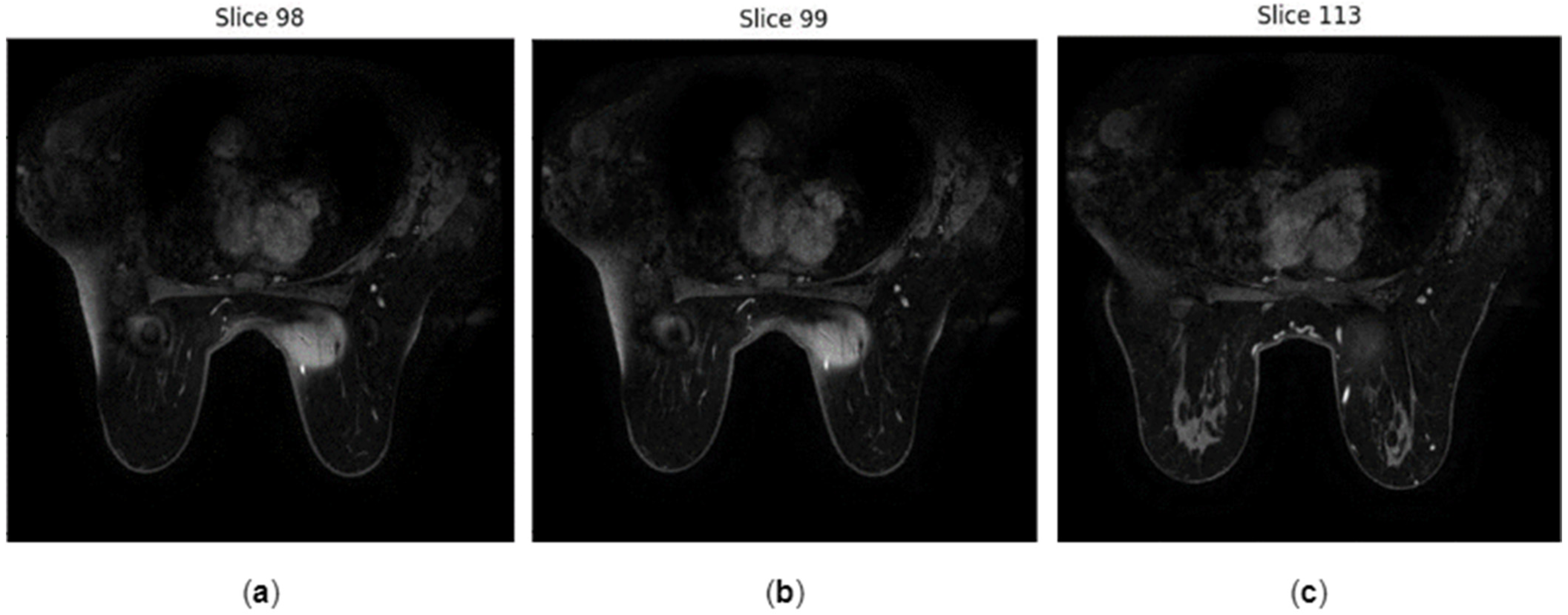 Jimaging 10 00115 g003