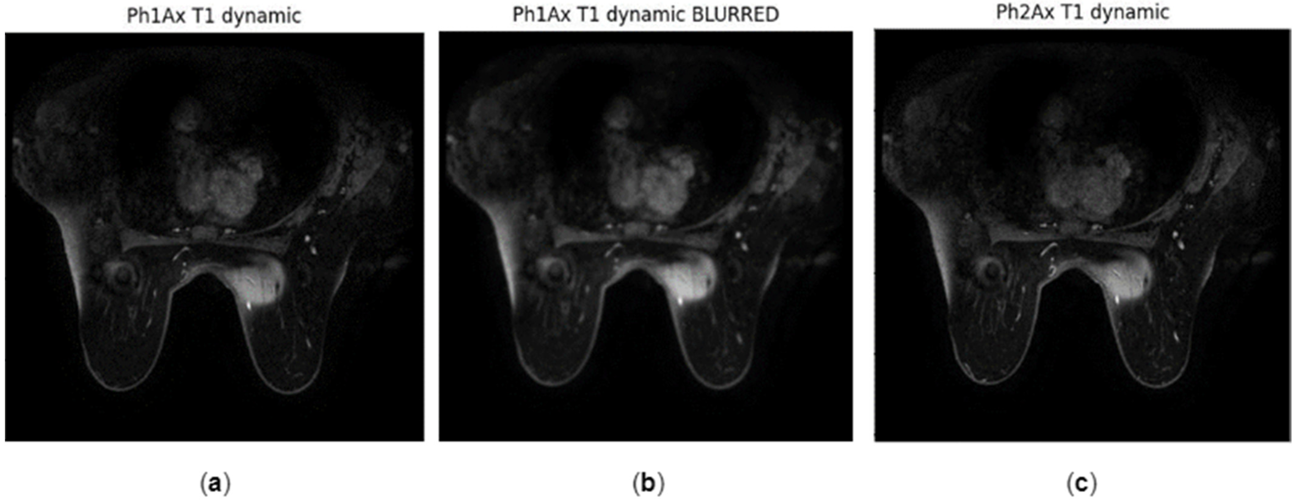 Jimaging 10 00115 g005