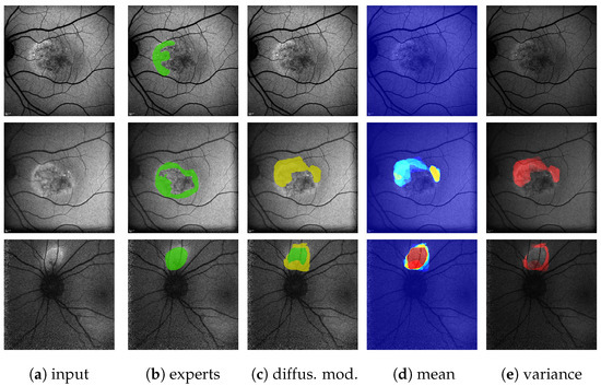 Jimaging 10 00116 g0a8