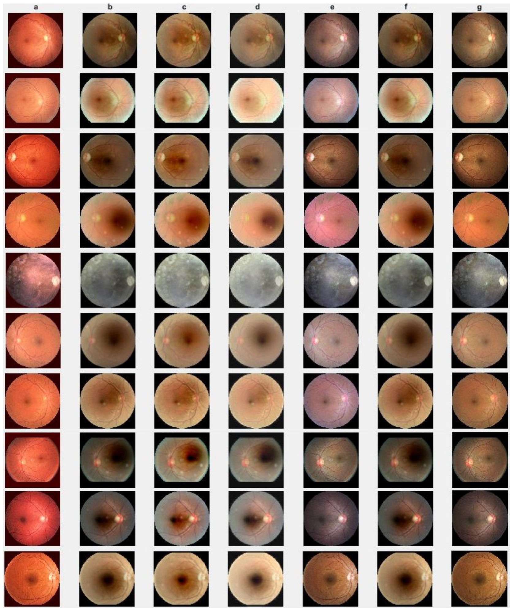 Jimaging 10 00151 g004