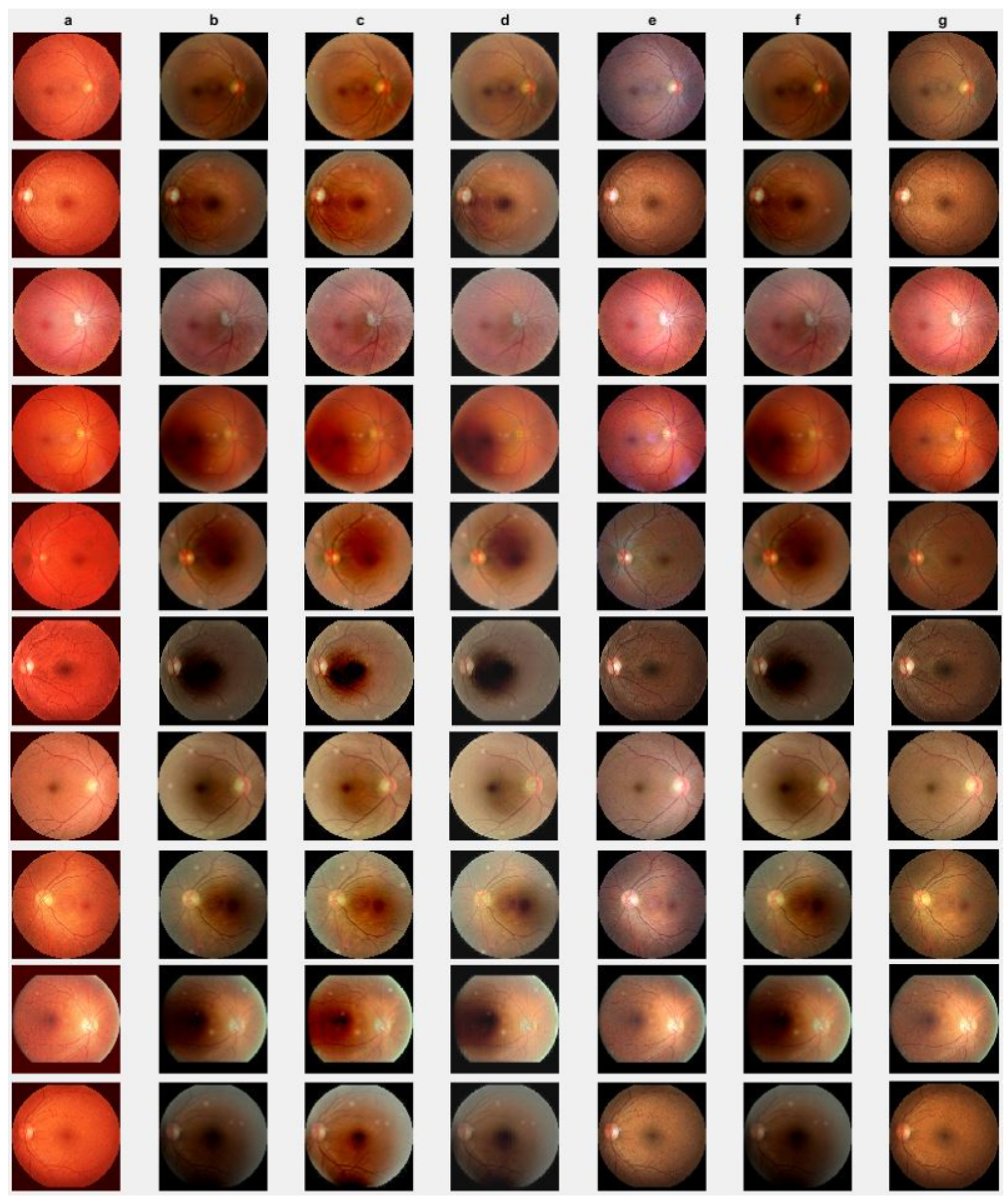 Jimaging 10 00151 g006a