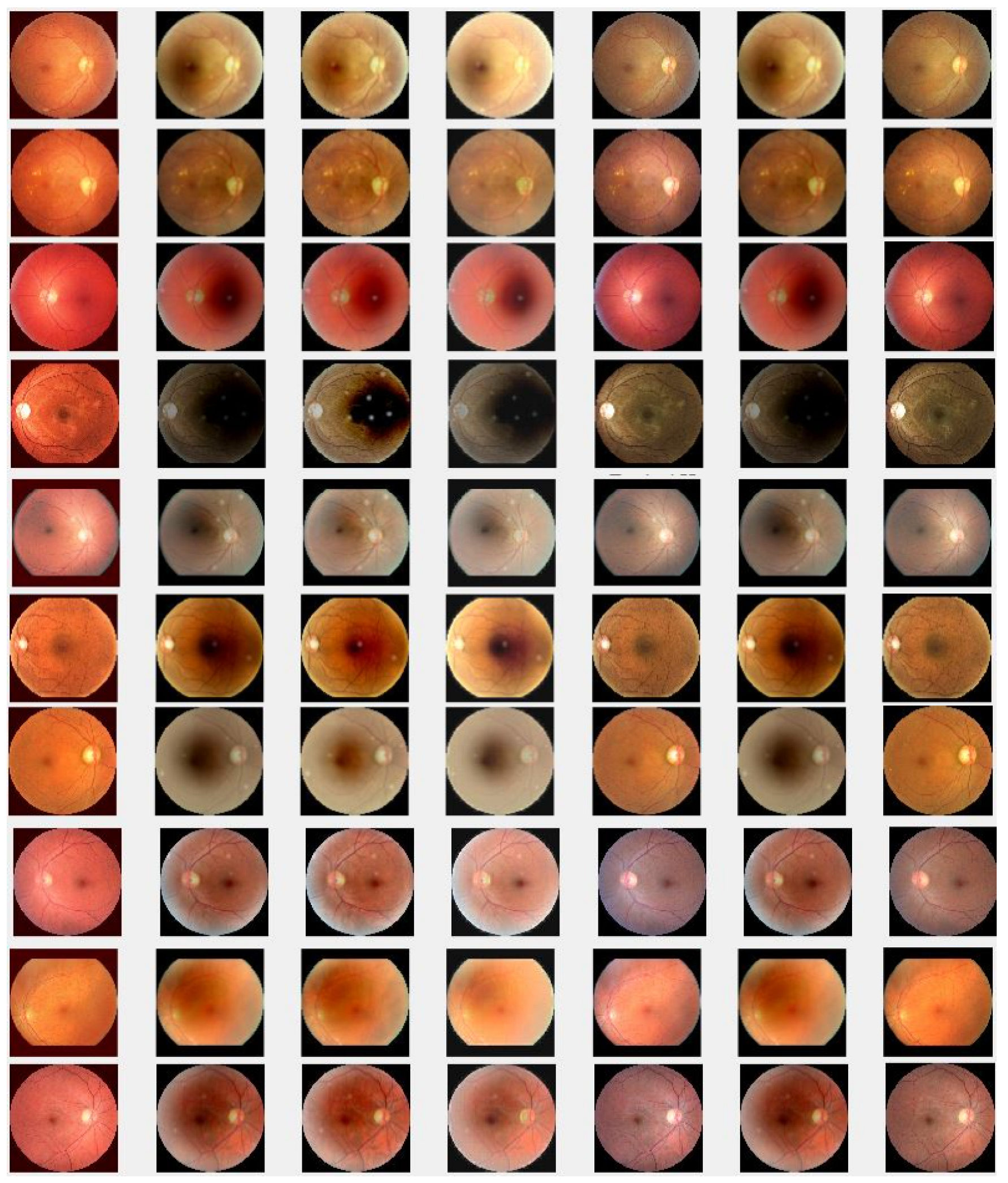 Jimaging 10 00151 g006b