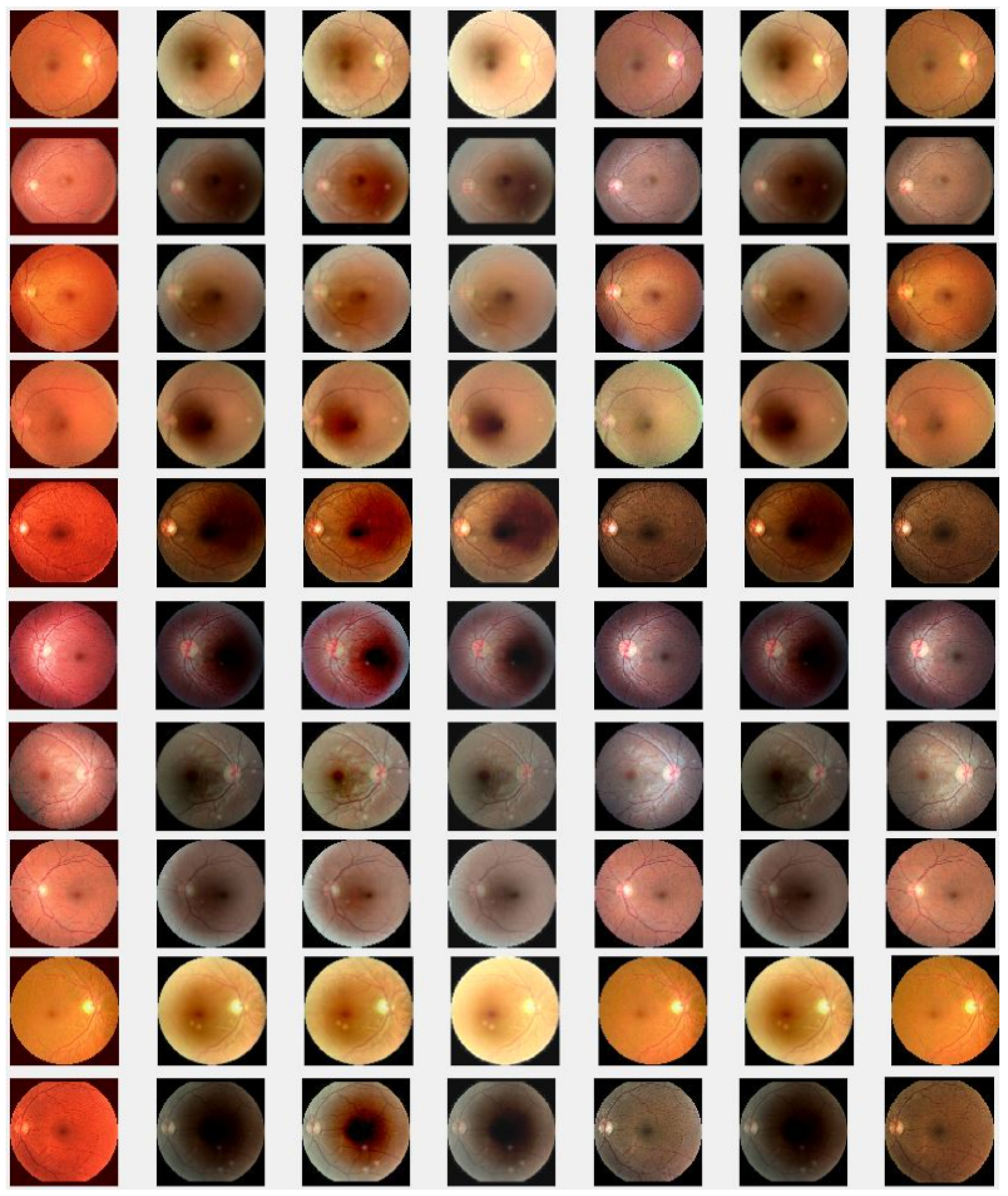 Jimaging 10 00151 g006d