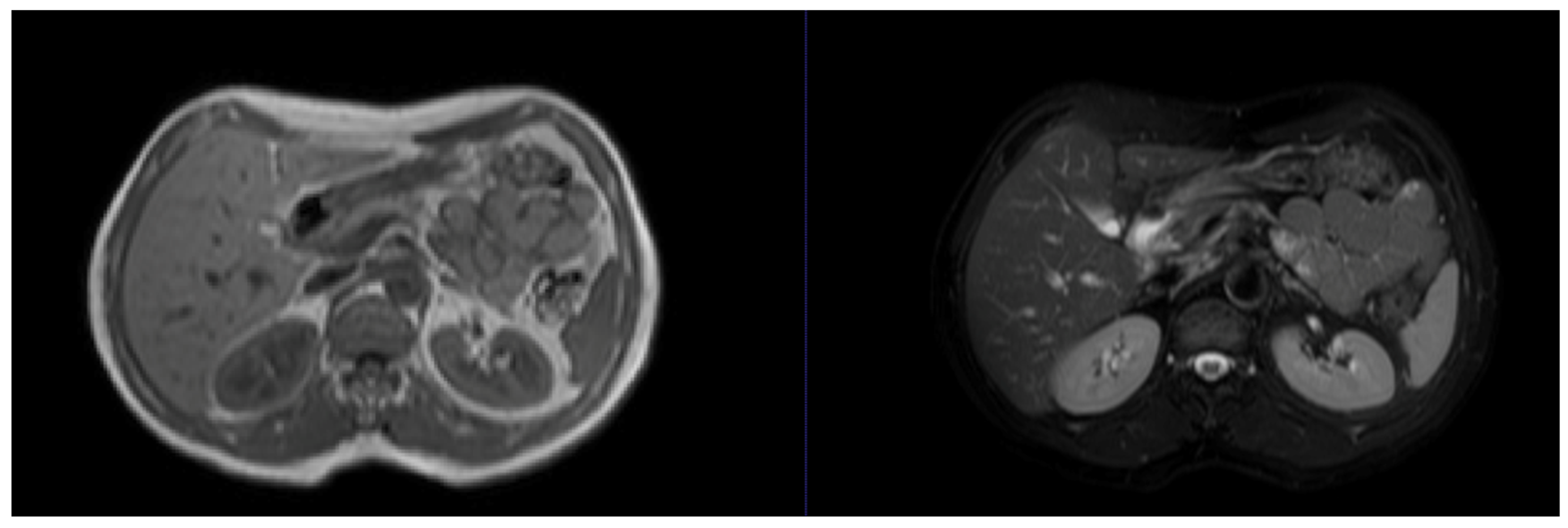 Jimaging 10 00202 g004