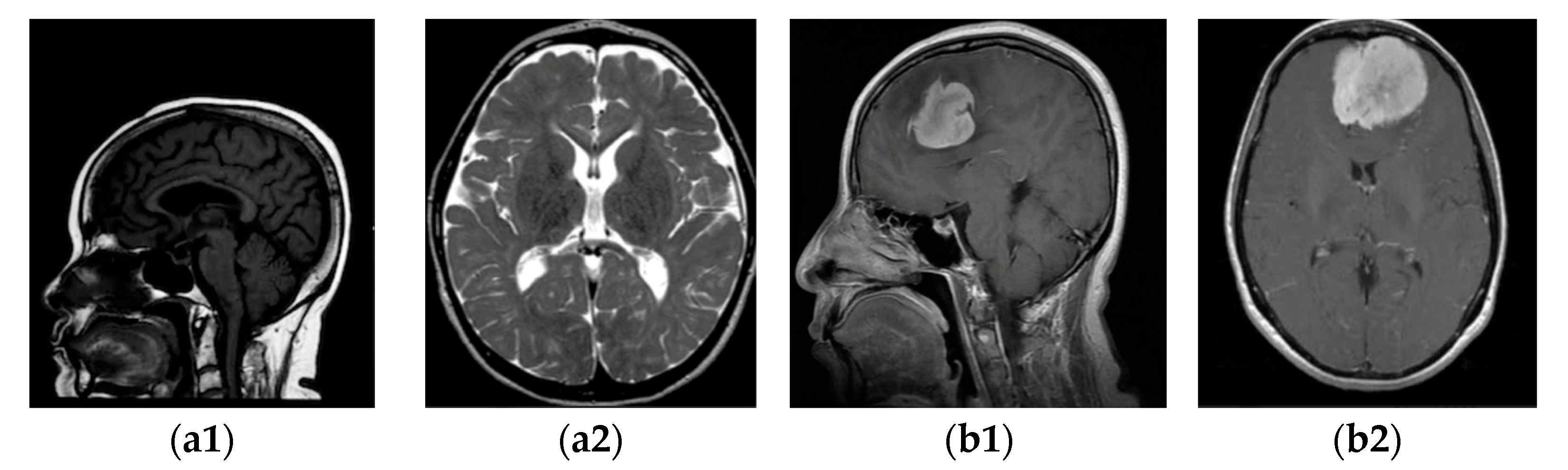 Jimaging 10 00235 g002