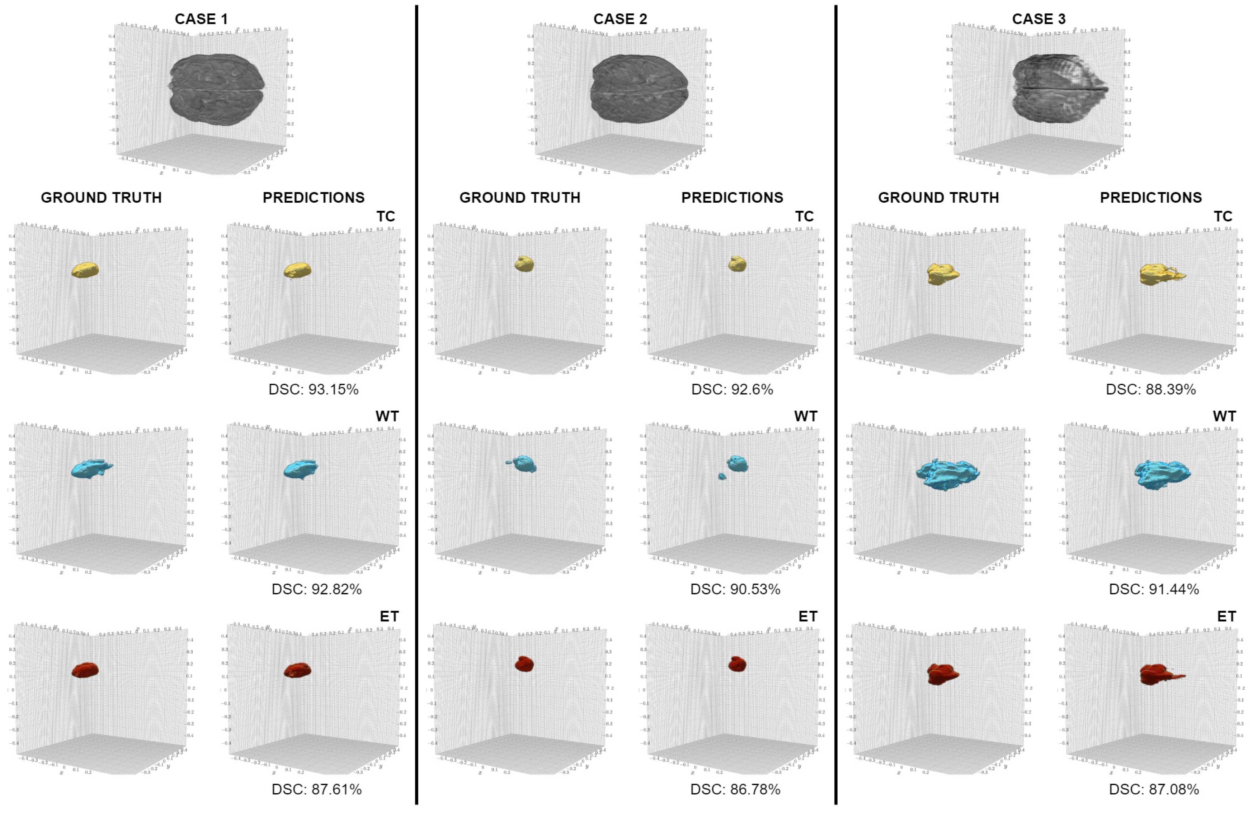 Jimaging 11 00008 g005