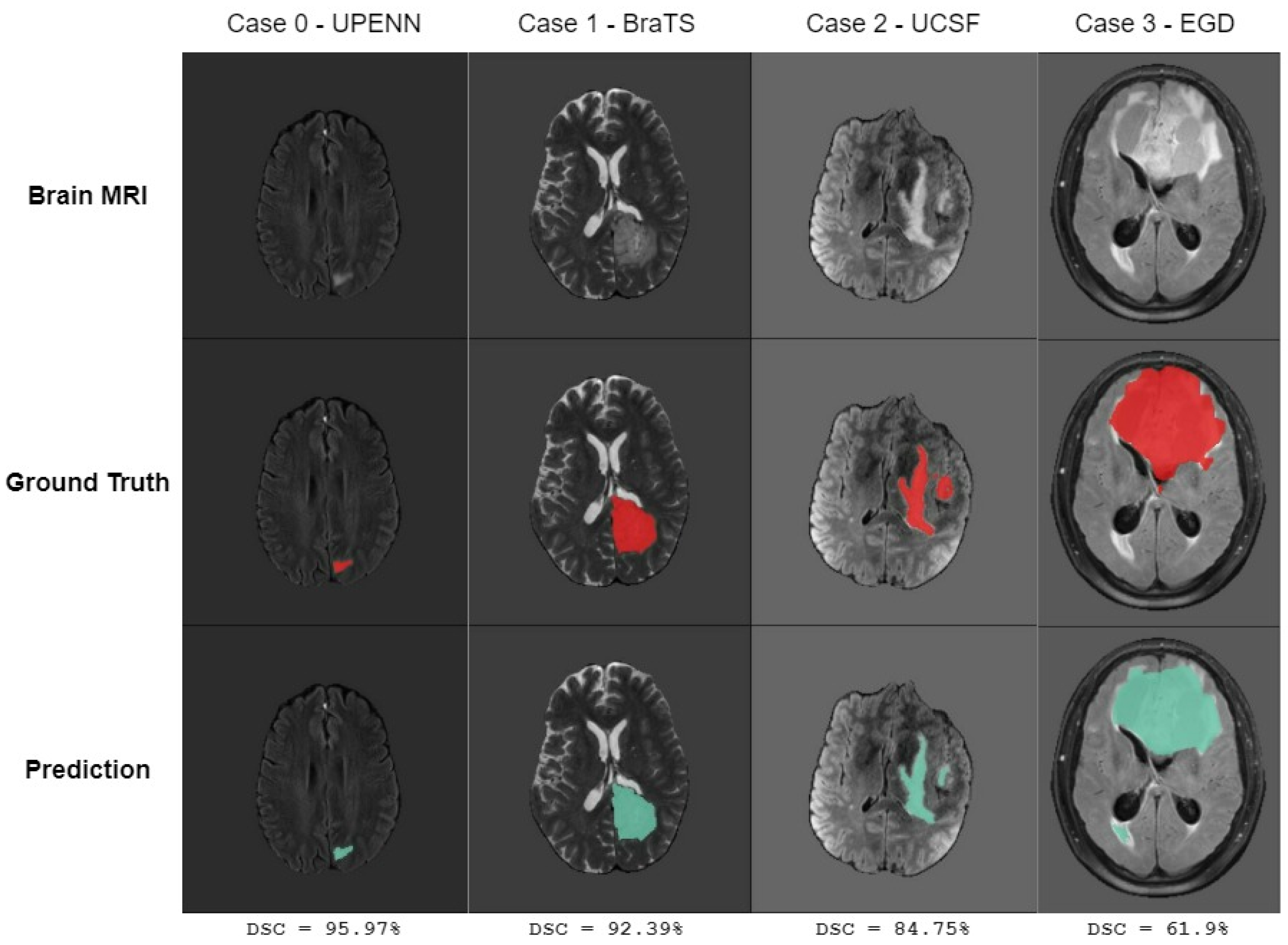 Jimaging 11 00008 g007