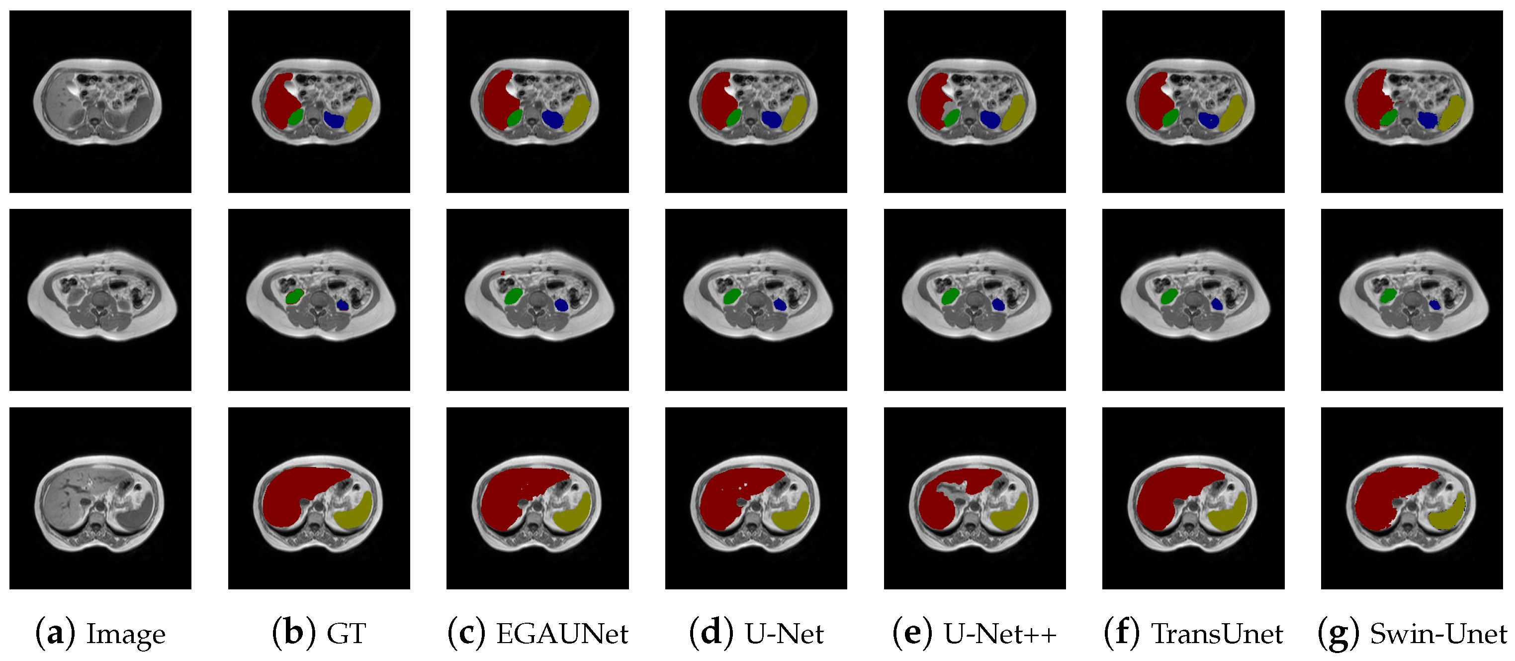 Jimaging 11 00019 g008