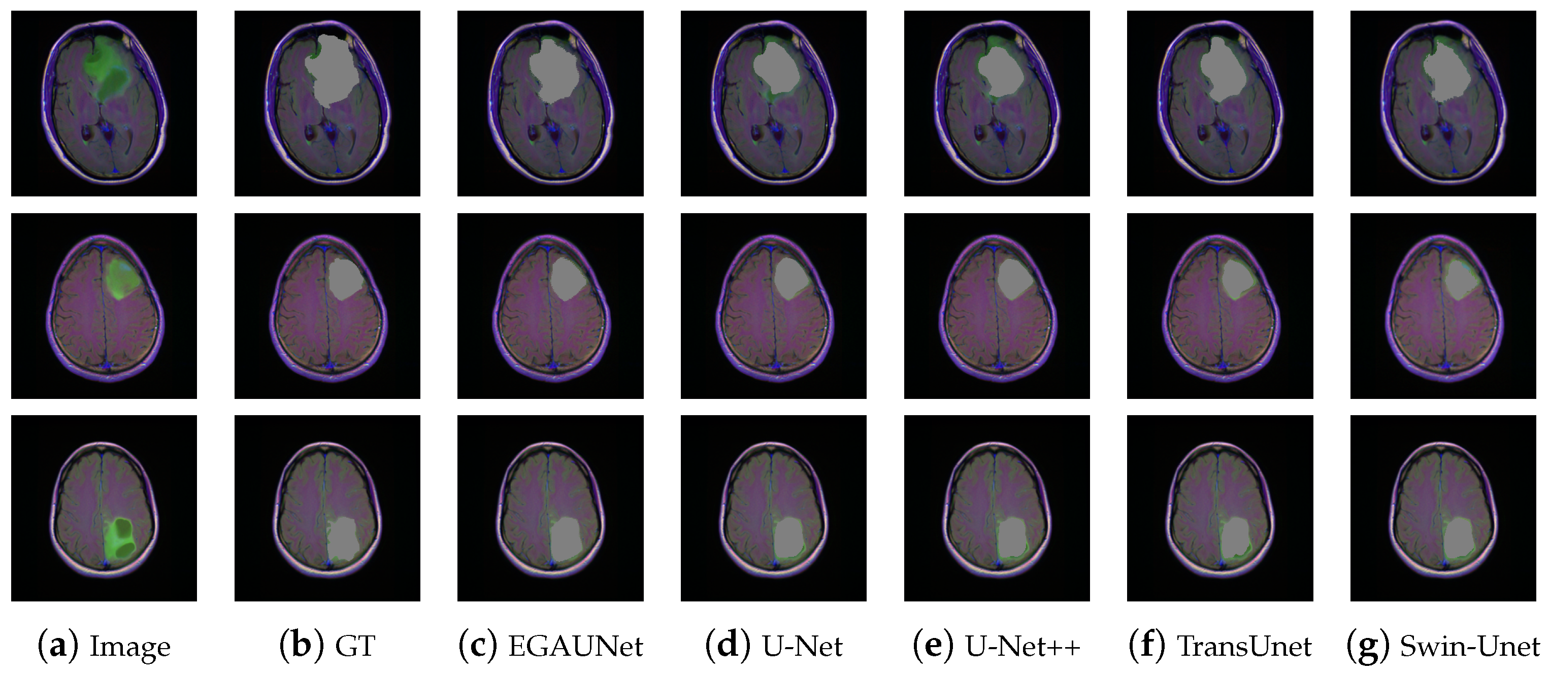 Jimaging 11 00019 g009